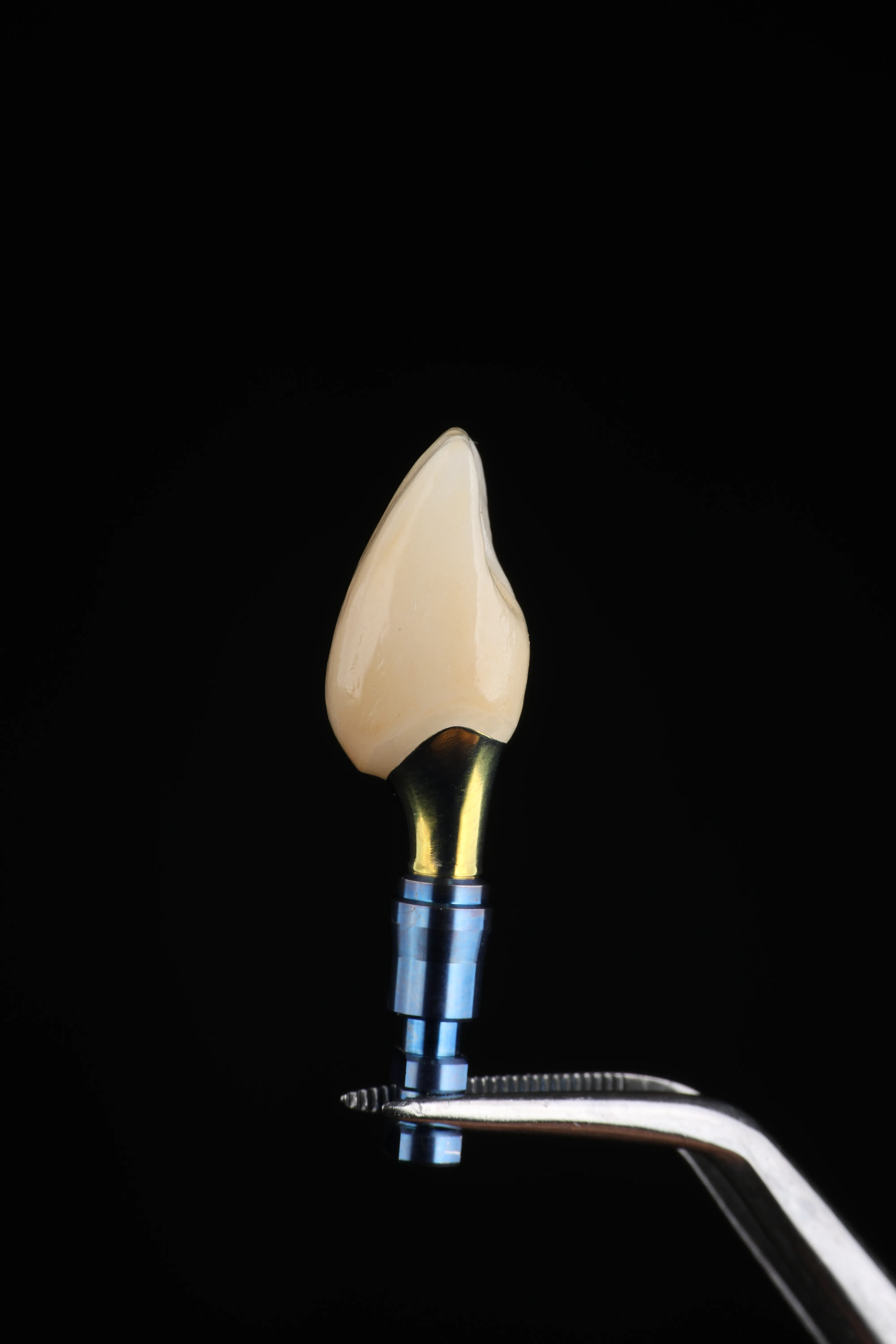 Single dental implant smile result at Livewell Dental in Fairfax Station, VA