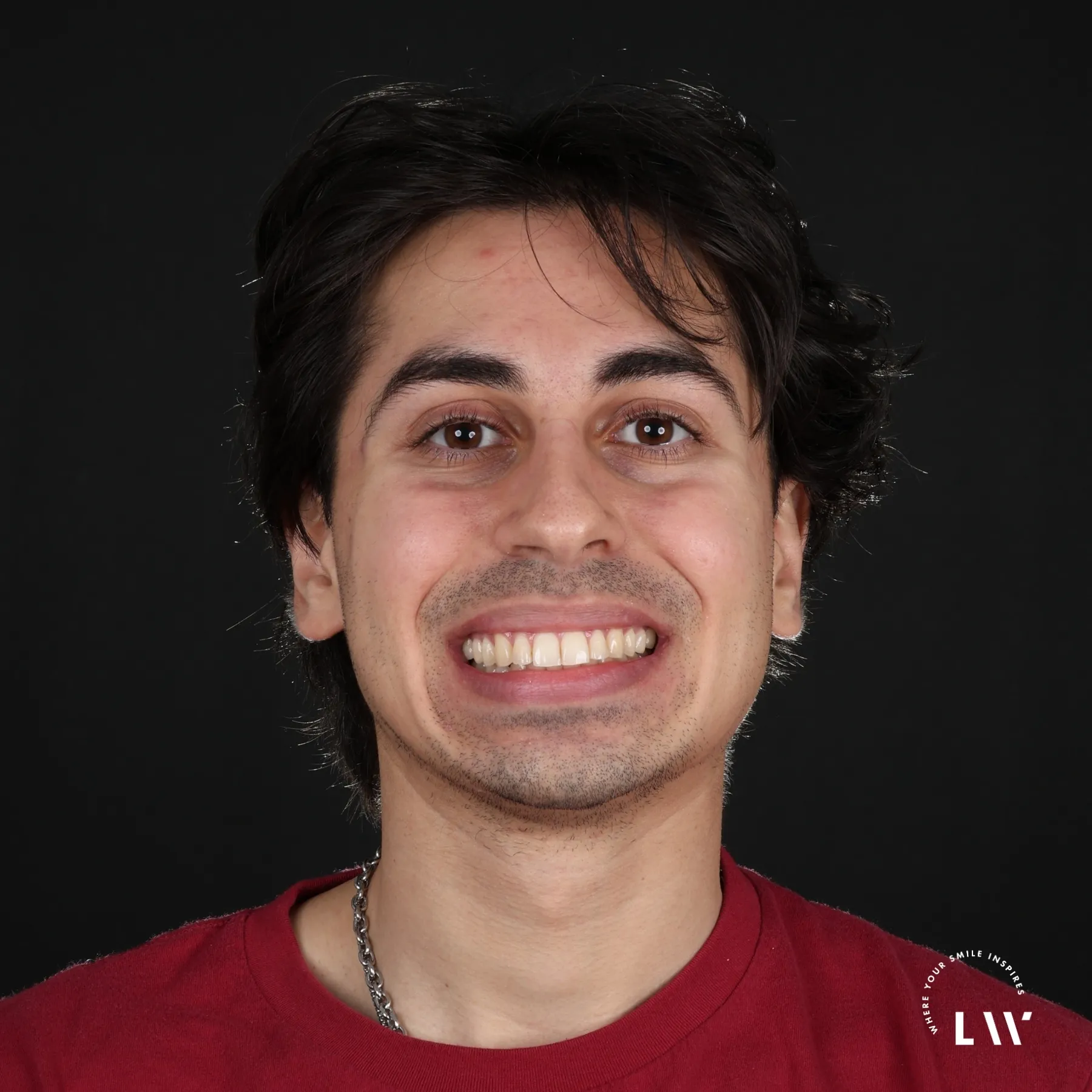 Dental crown restoration result by Dr. Chris Kim at Livewell Dental