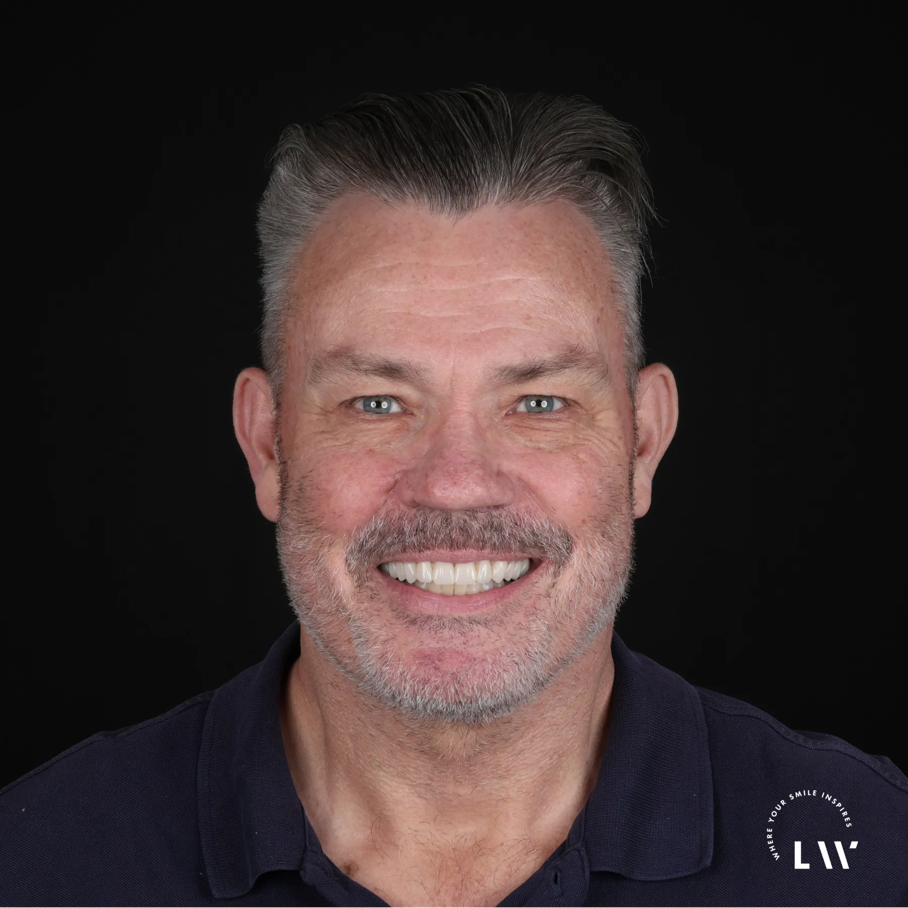 After full-mouth reconstruction result at Livewell Dental, Fairfax Station, VA