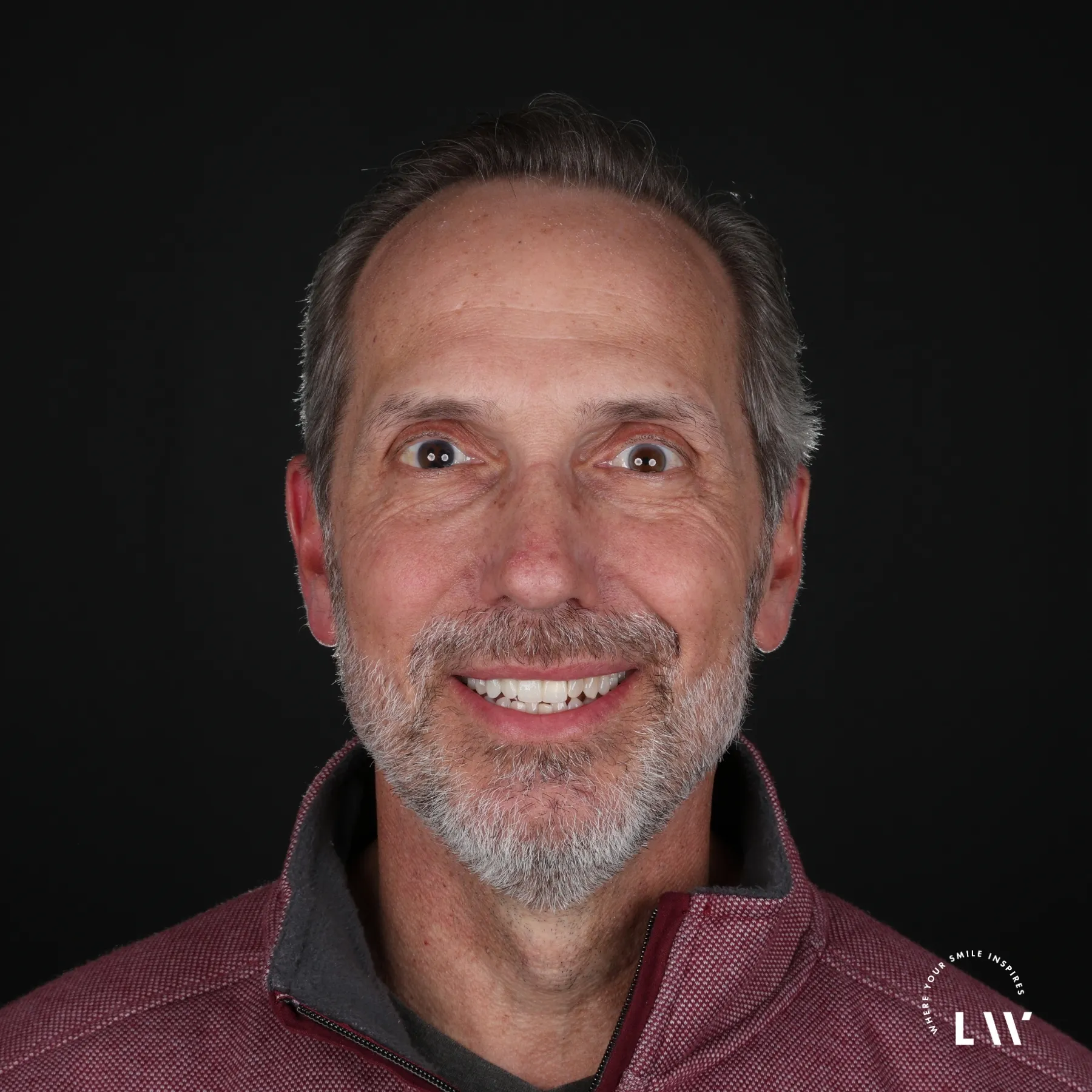 after implant bridge case at Livewell Dental