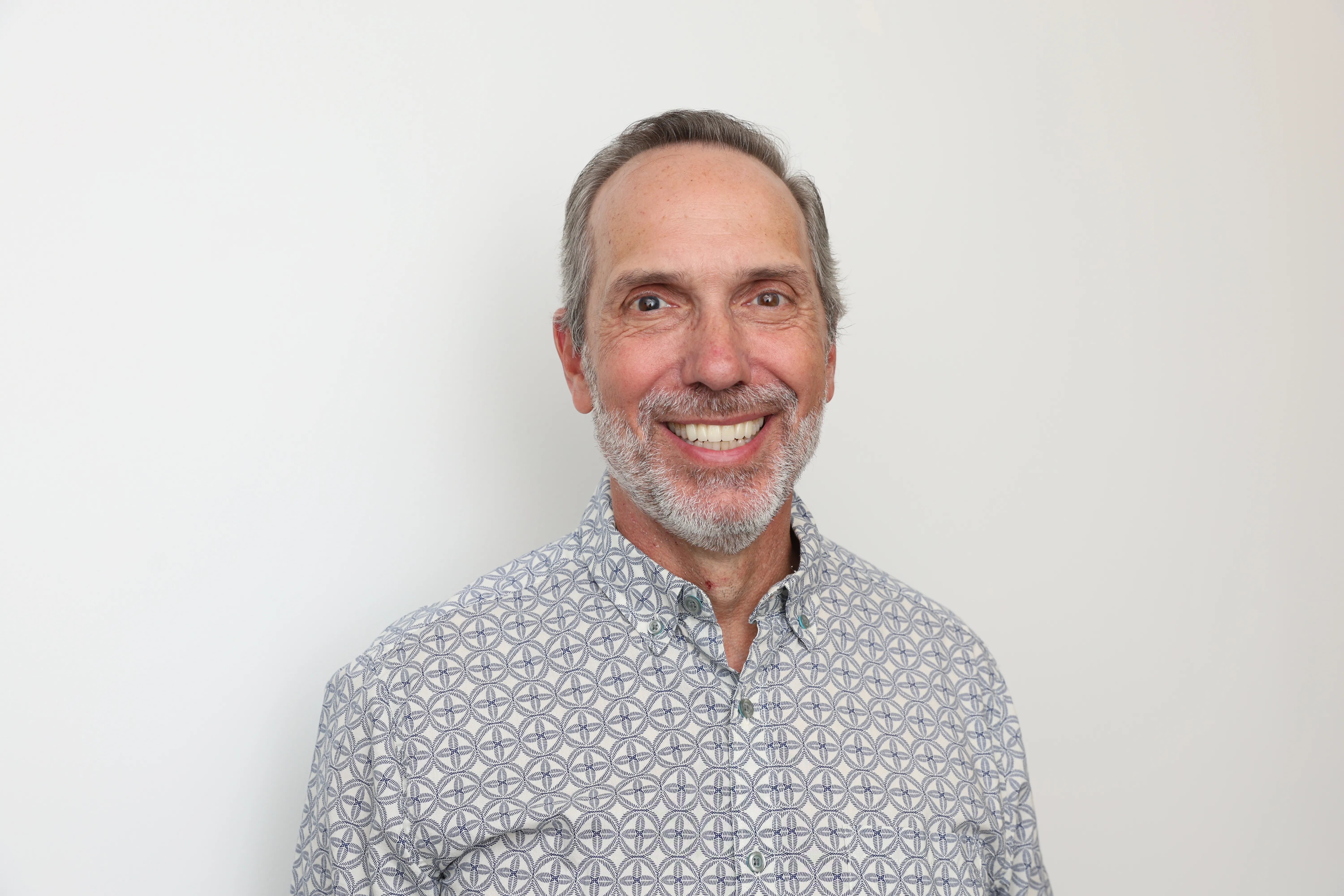 After All-on-X implant-supported smile makeover at Livewell Dental, Fairfax Station, VA