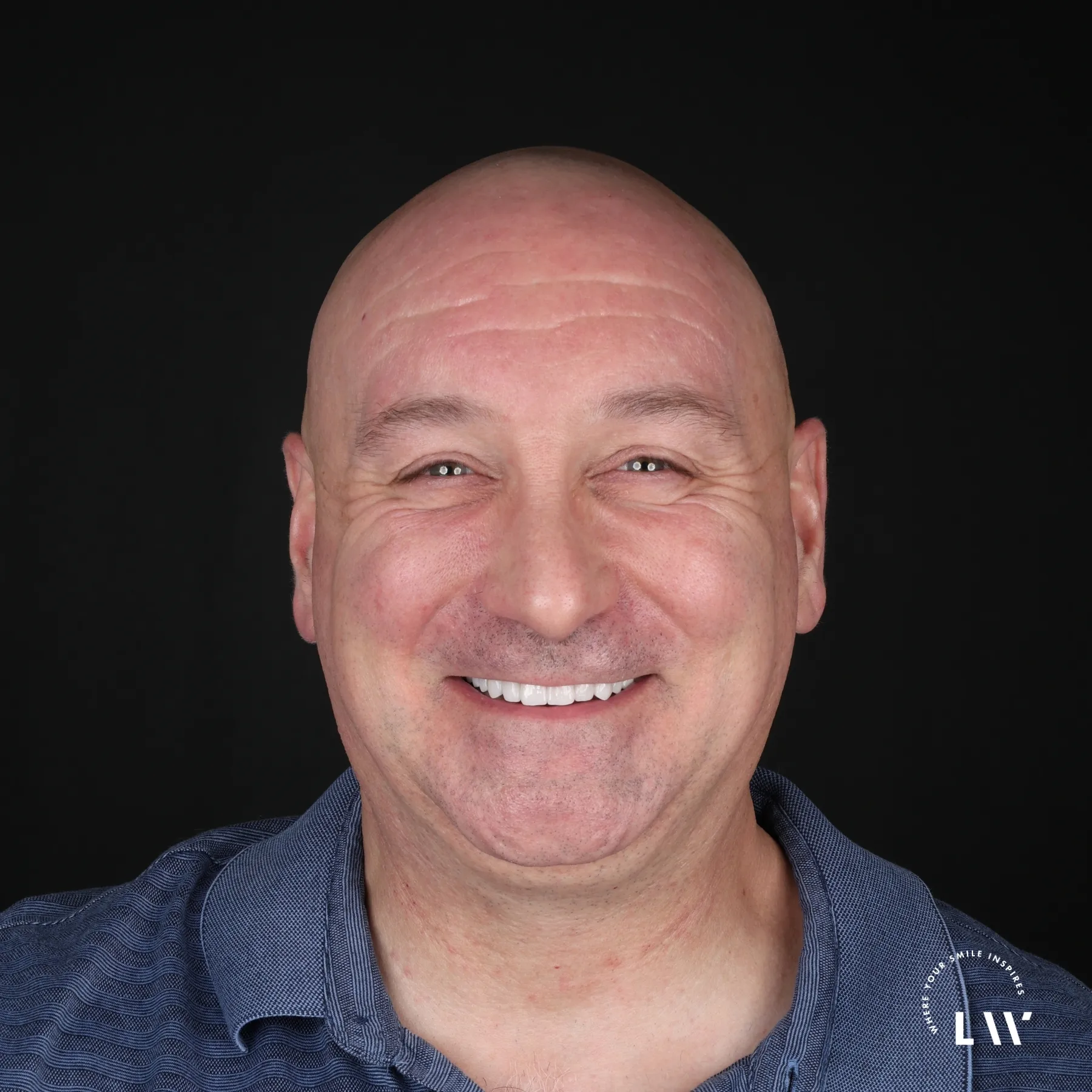 After inlay or onlay restorative dentistry treatment at Livewell Dental
