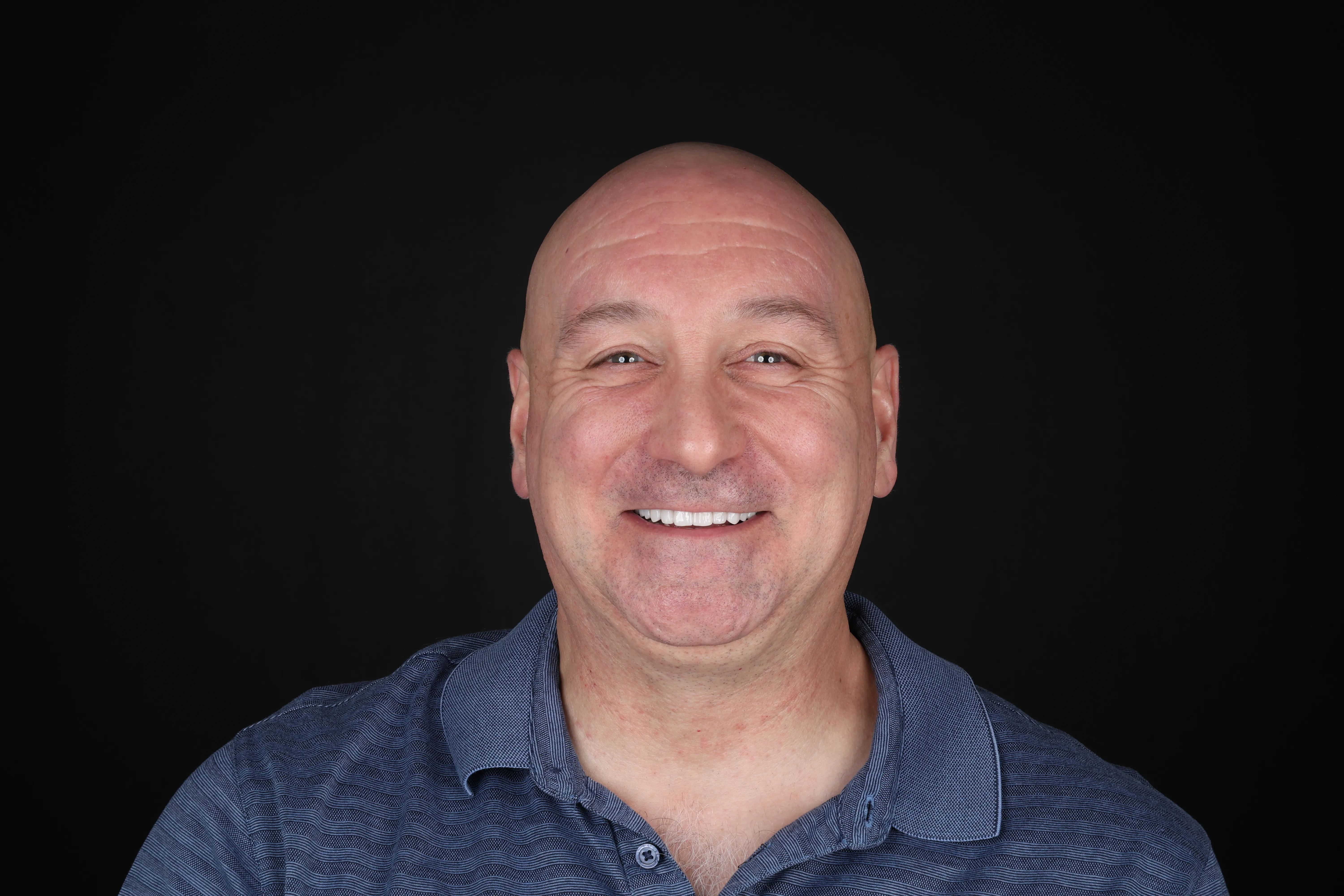 Inlay and onlay restorative dentistry result at Livewell Dental