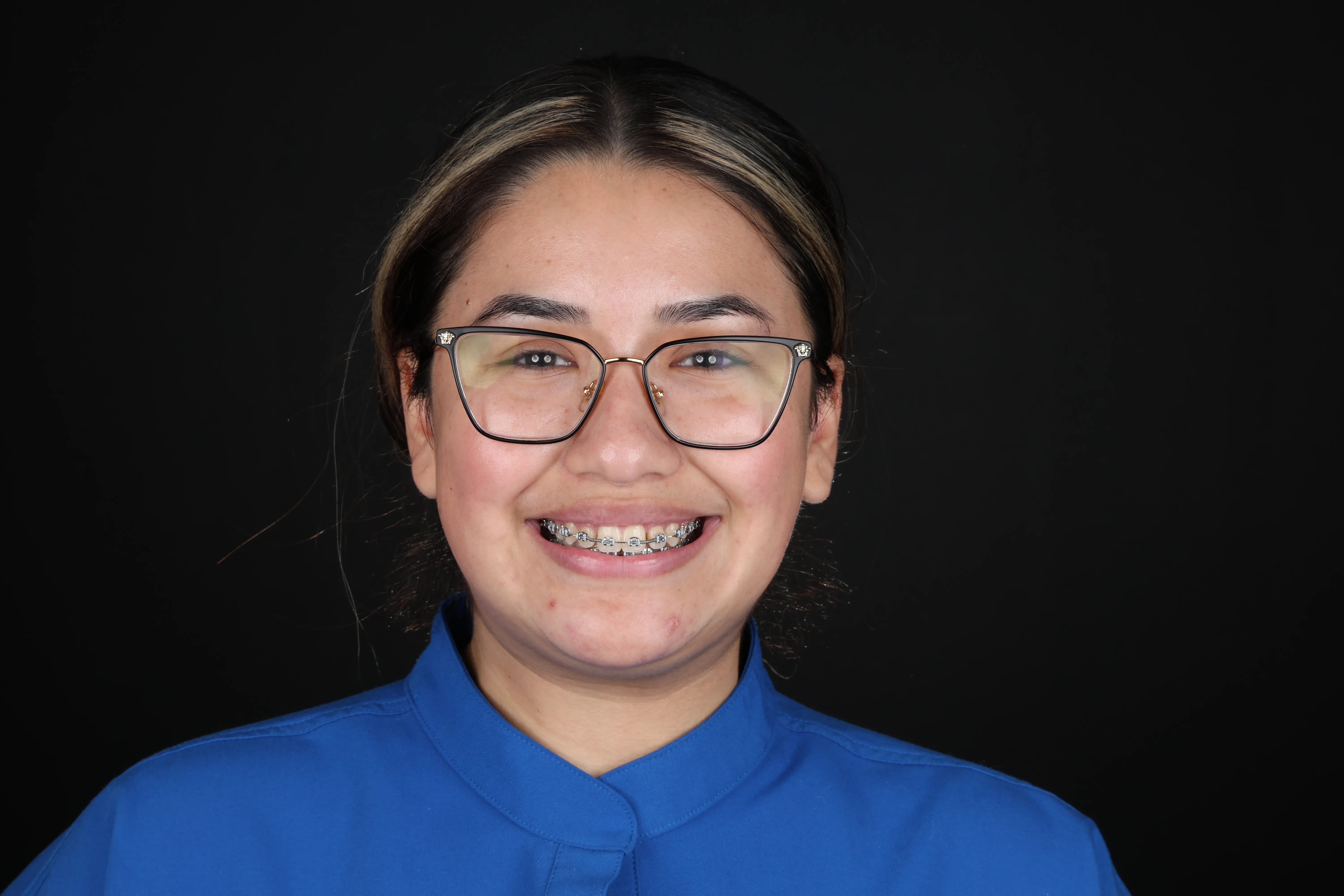 After braces treatment result at Livewell Dental