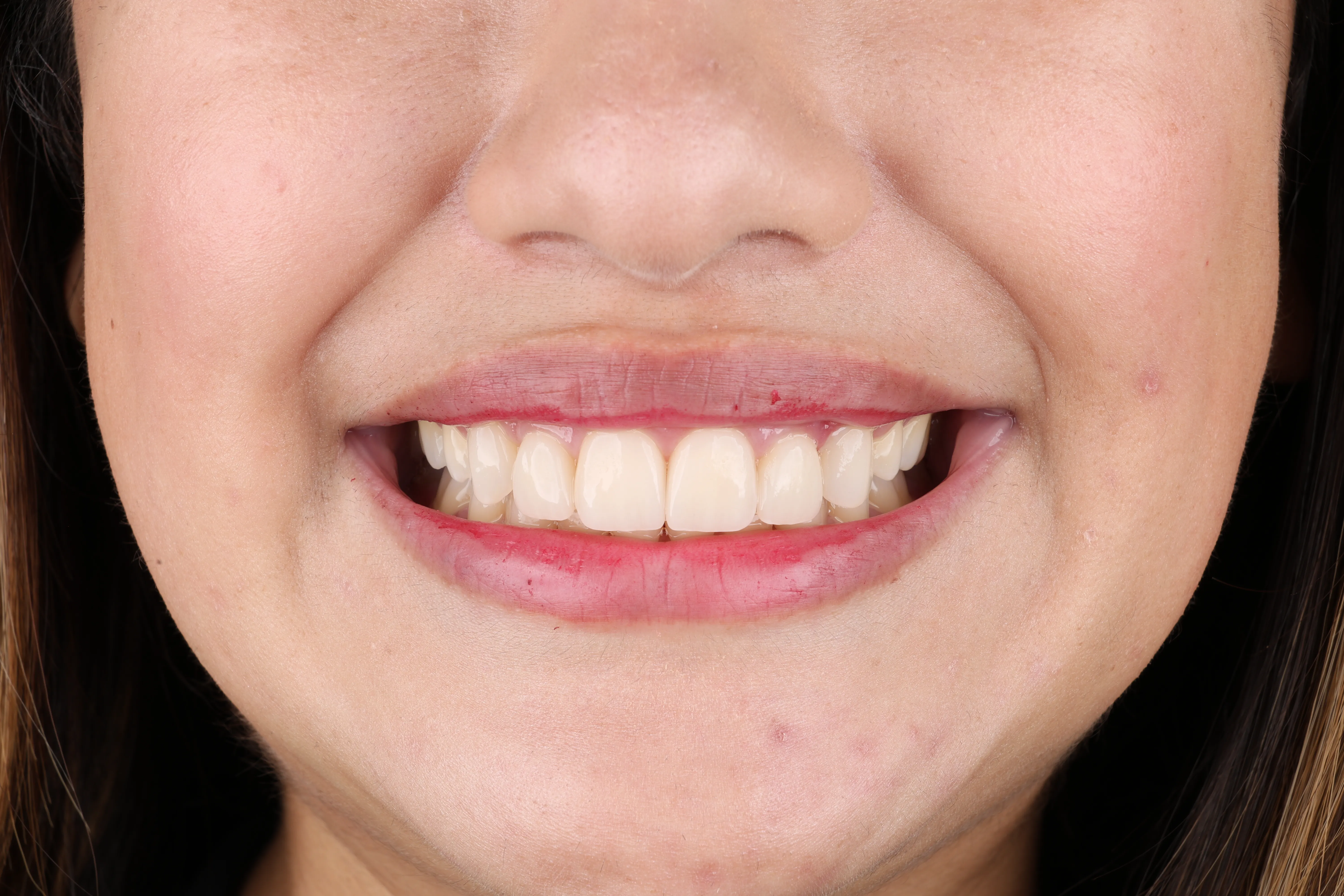 Orthodontic treatment planning at Livewell Dental