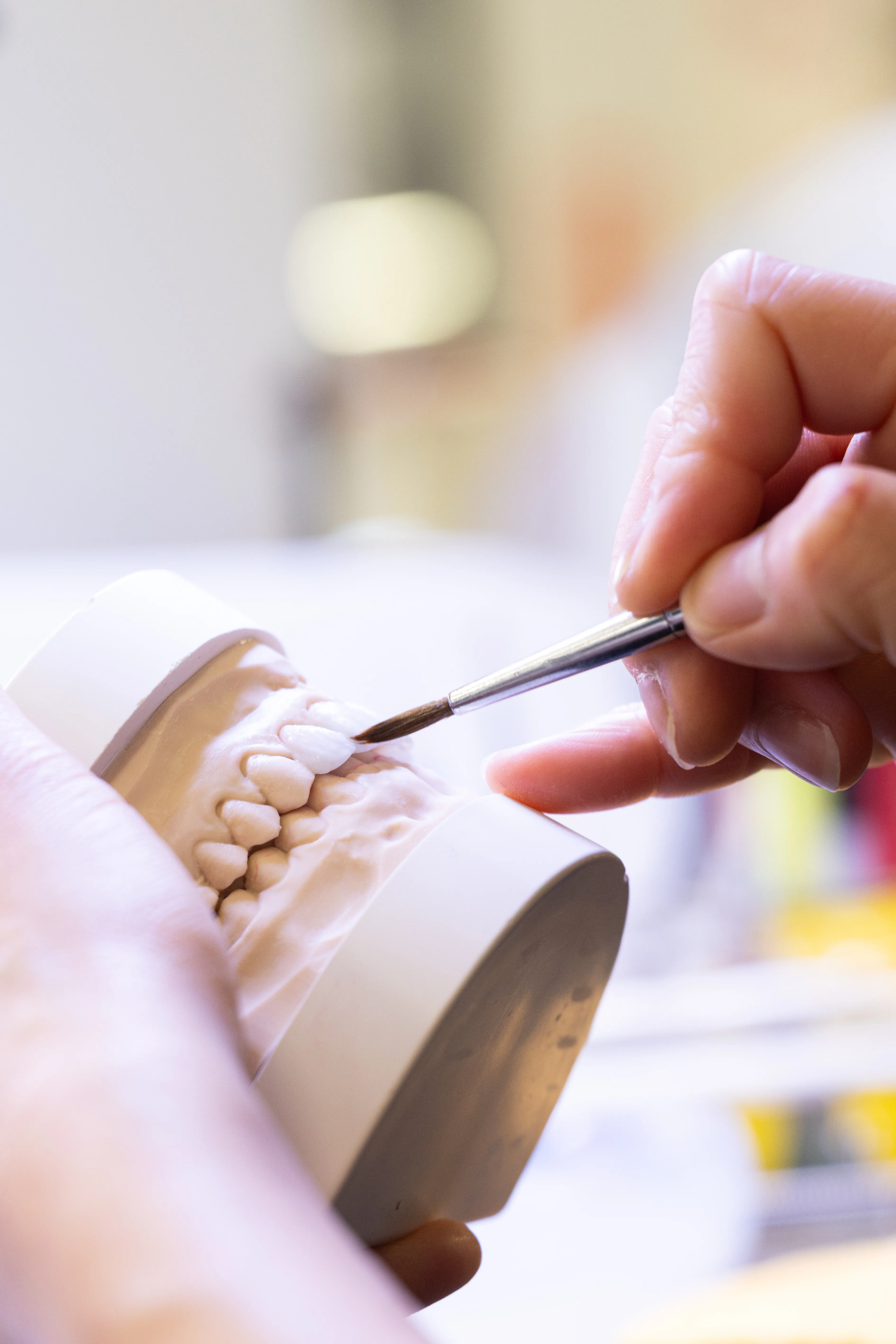 Close-up of a dental veneer model and restorative tools
