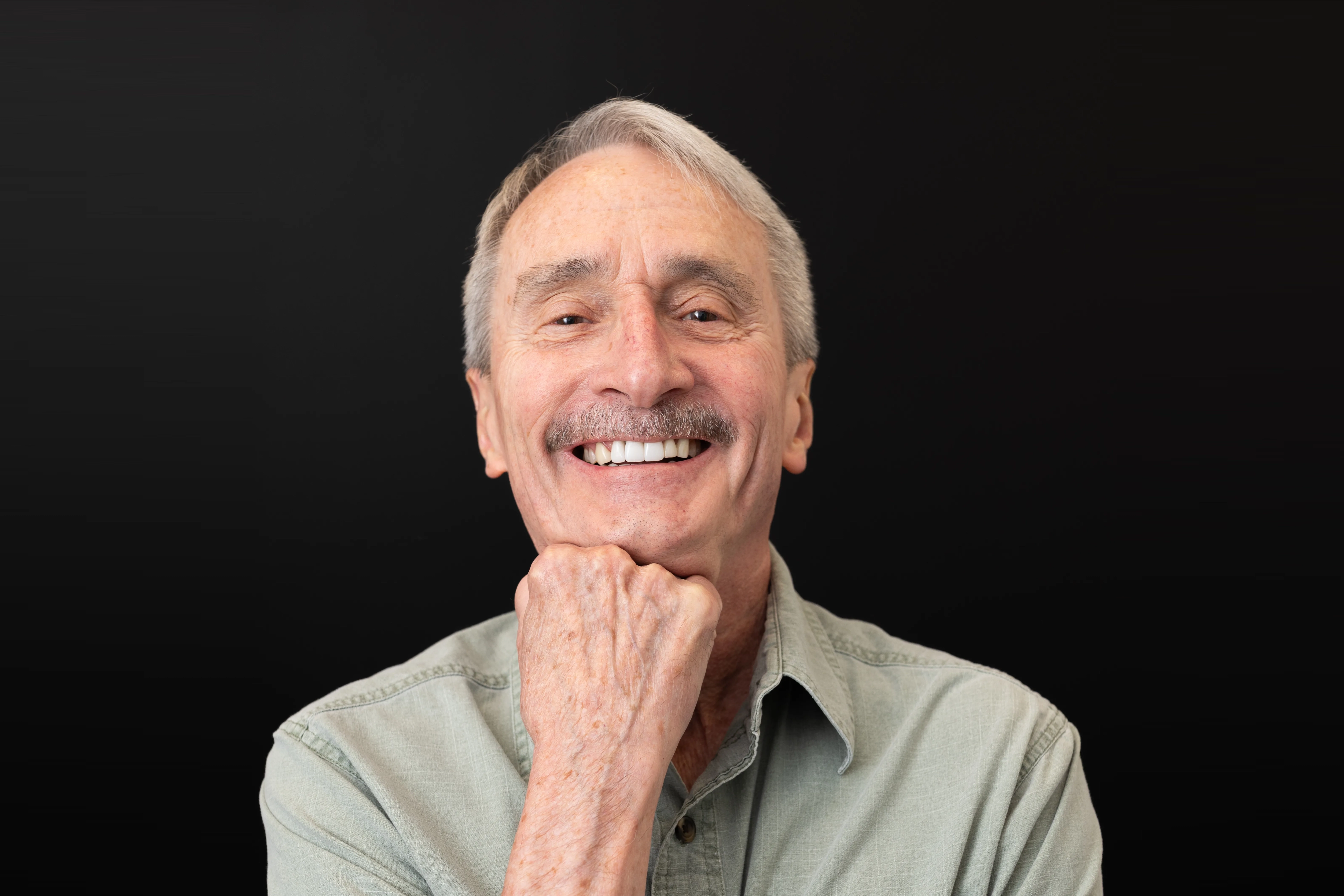 Before photo: patient with composite bonding and gum surgery case at Livewell Dental