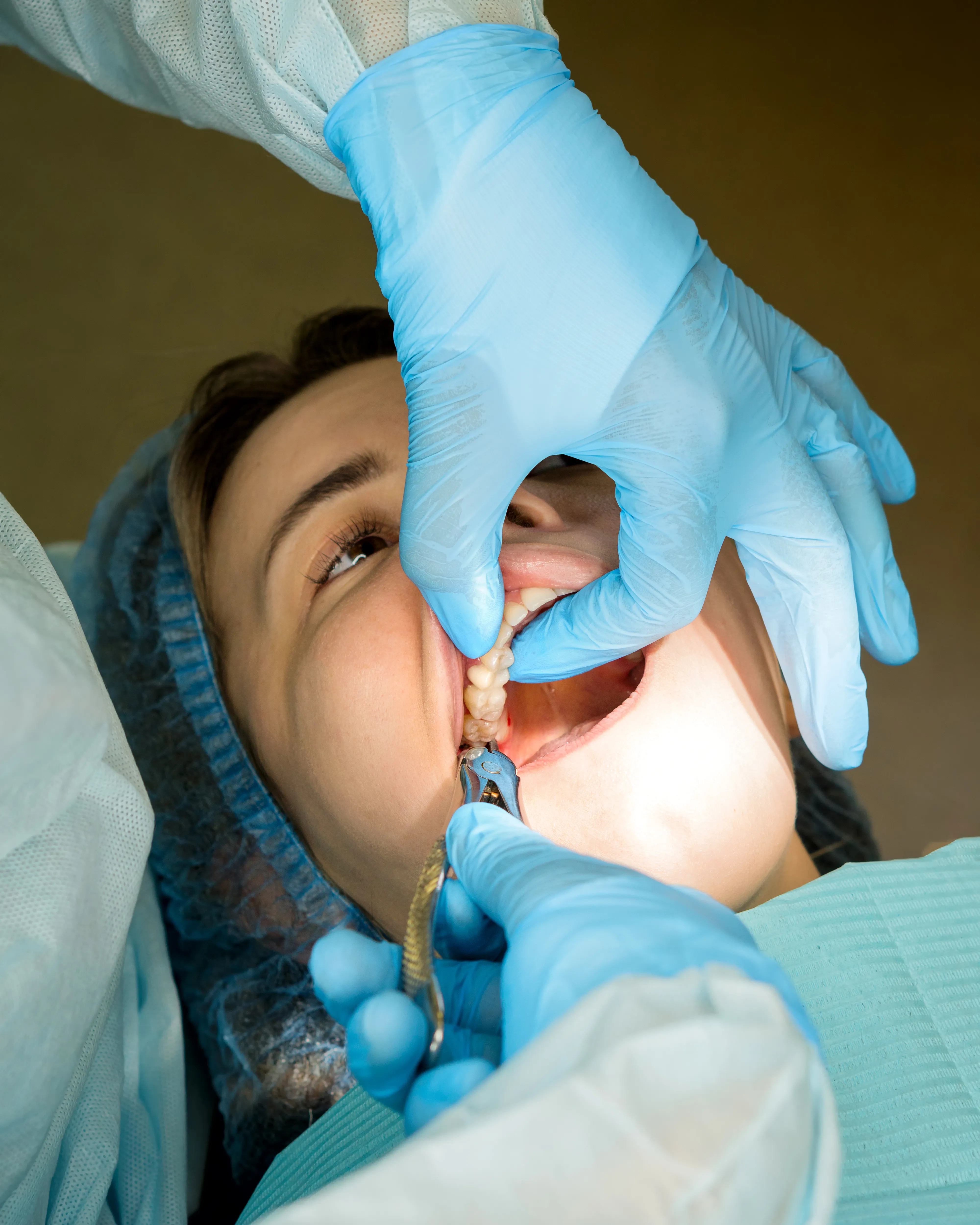 tooth removal. Extraction