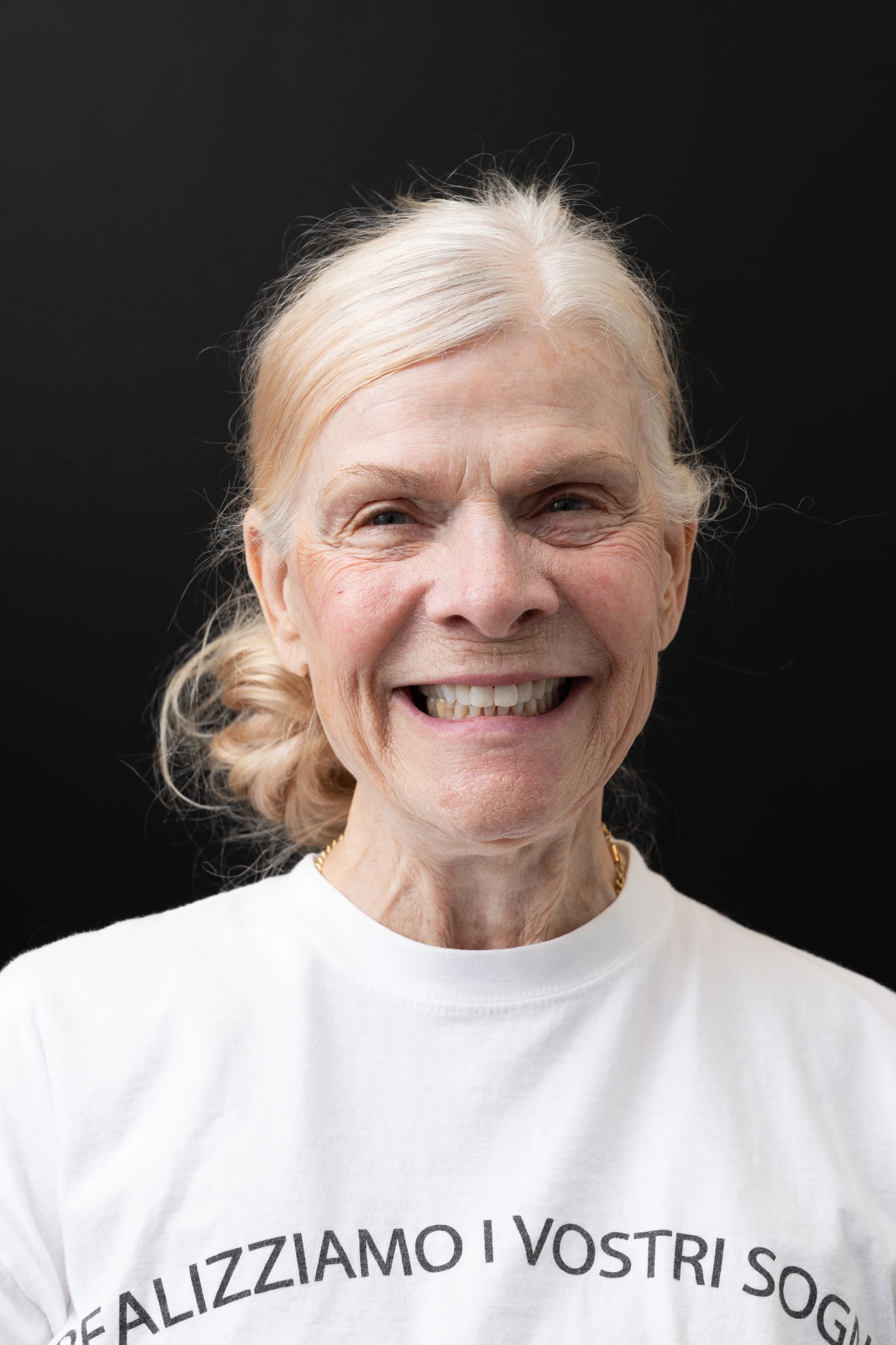 after full-mouth reconstruction result at Livewell Dental, Fairfax Station, VA