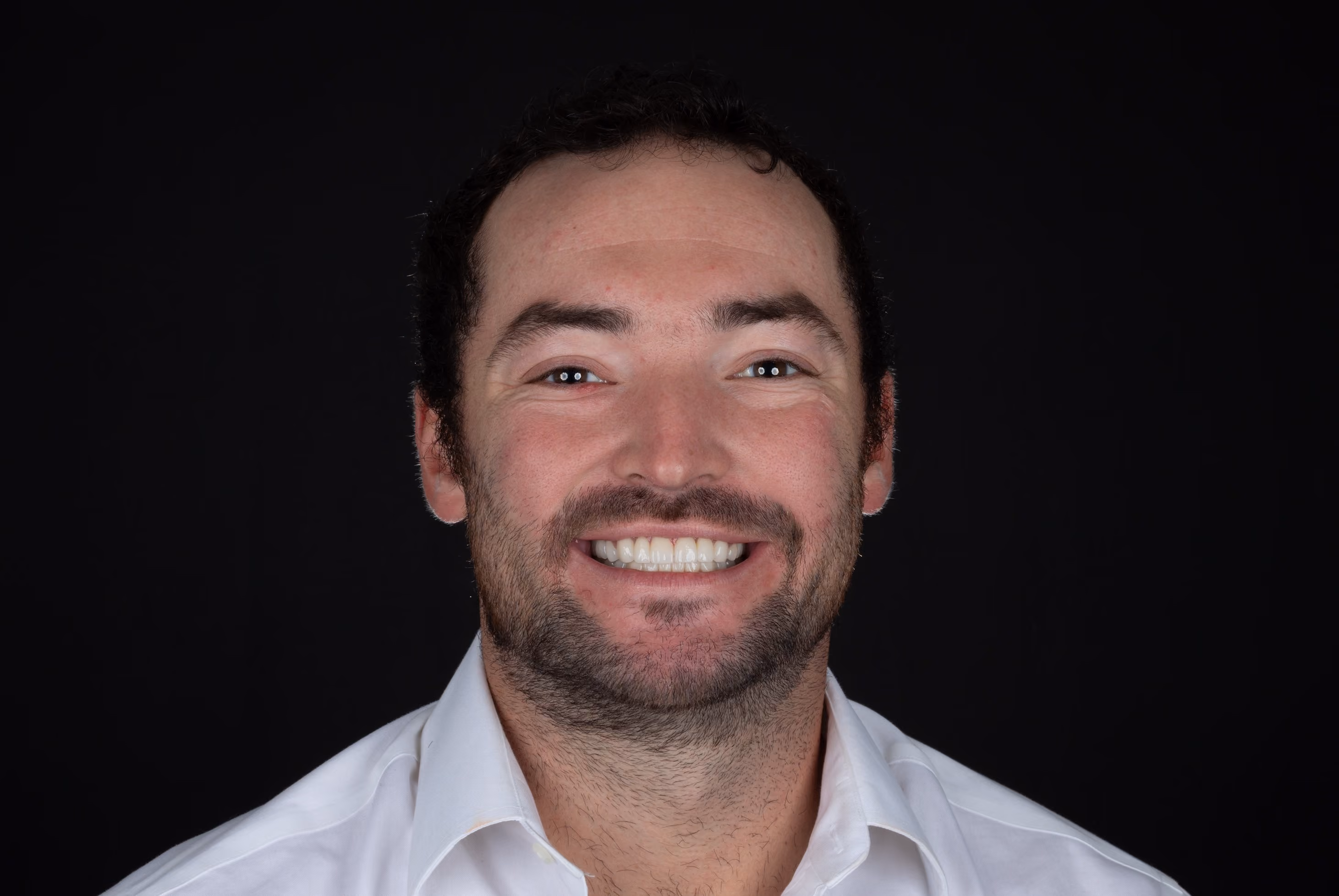 The same patient smiling after restorative treatment at Livewell Dental