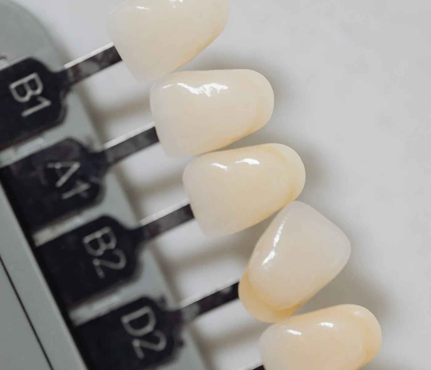 Porcelain shade guide tabs used to match veneer colour
