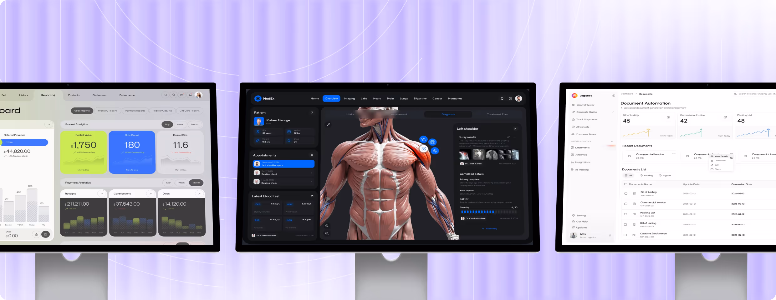 Three computer monitors displaying different dashboards: sales analytics, a medical anatomy and patient data interface, and document automation software.