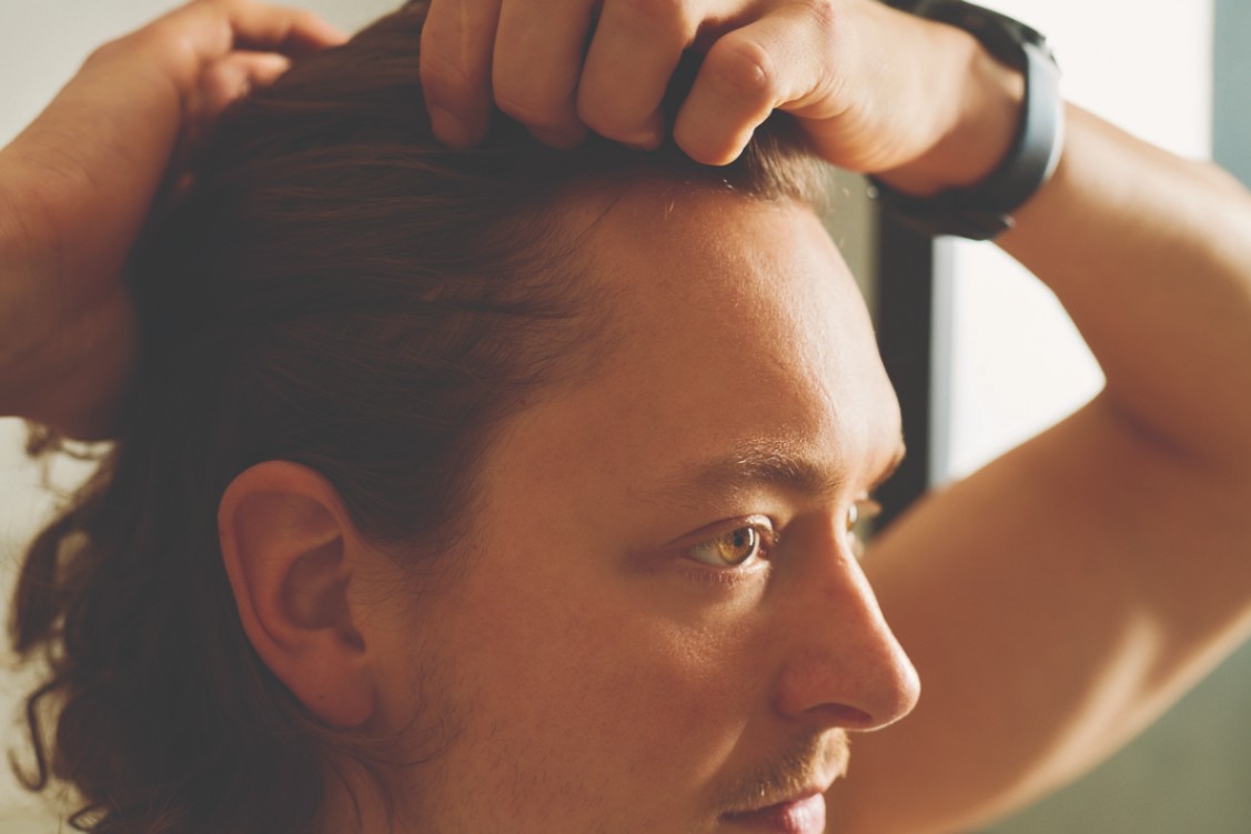 Recognising the signs of hair loss in men | Fellos