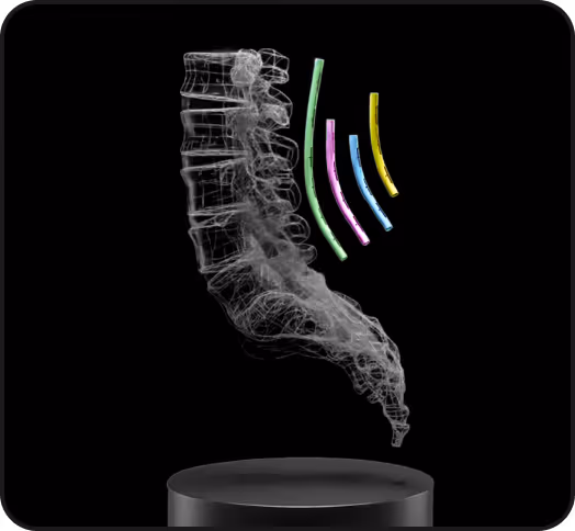 Transparent 3D model of a human lumbar spine with five curved, colored rods floating beside it on a black background.