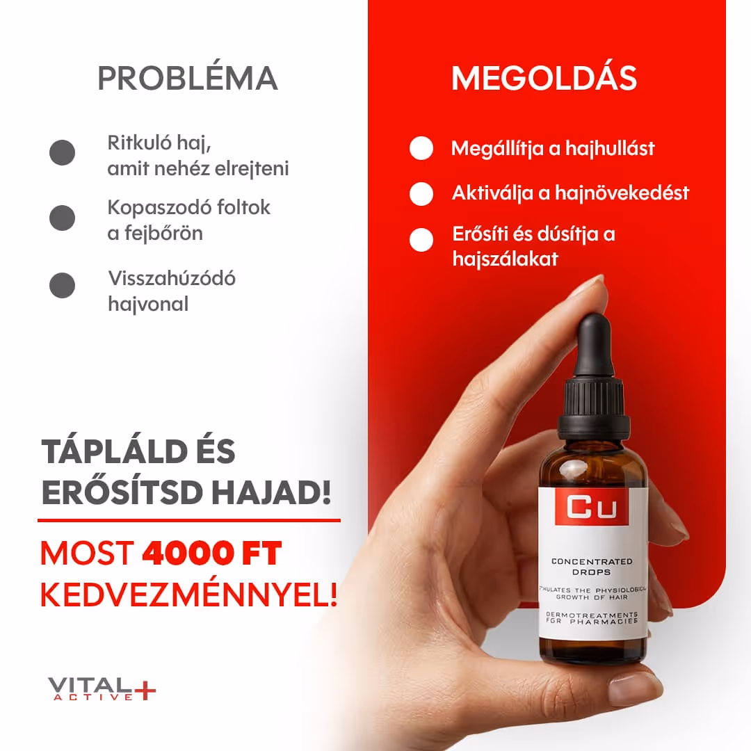 Hand holding a bottle of Cu Concentrated Drops hair treatment against a red and white background with Hungarian text listing hair loss problems and solutions, promoting a 4000 FT discount.