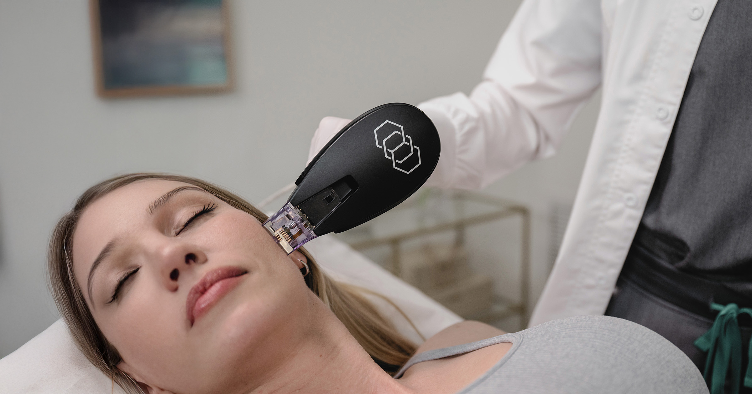Professional Morpheus8 facial treatment targeting skin laxity and tissue remodeling in Halifax, Nova Scotia