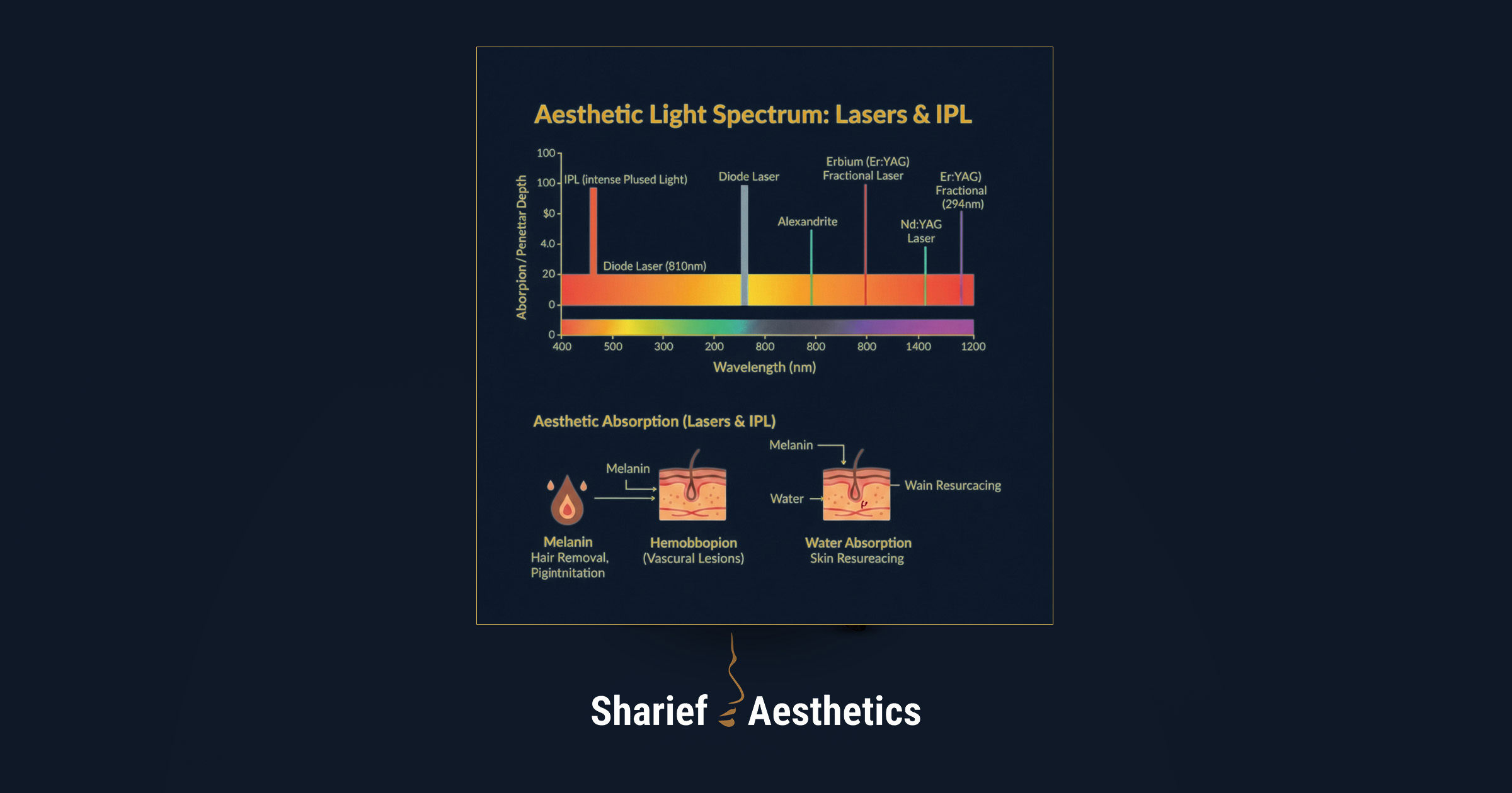 Clinical chart detailing the aesthetic light spectrum, comparing the broad nanometer range of IPL to specific laser wavelengths like Diode (810nm), Alexandrite, and Nd:YAG, along with their primary absorption targets