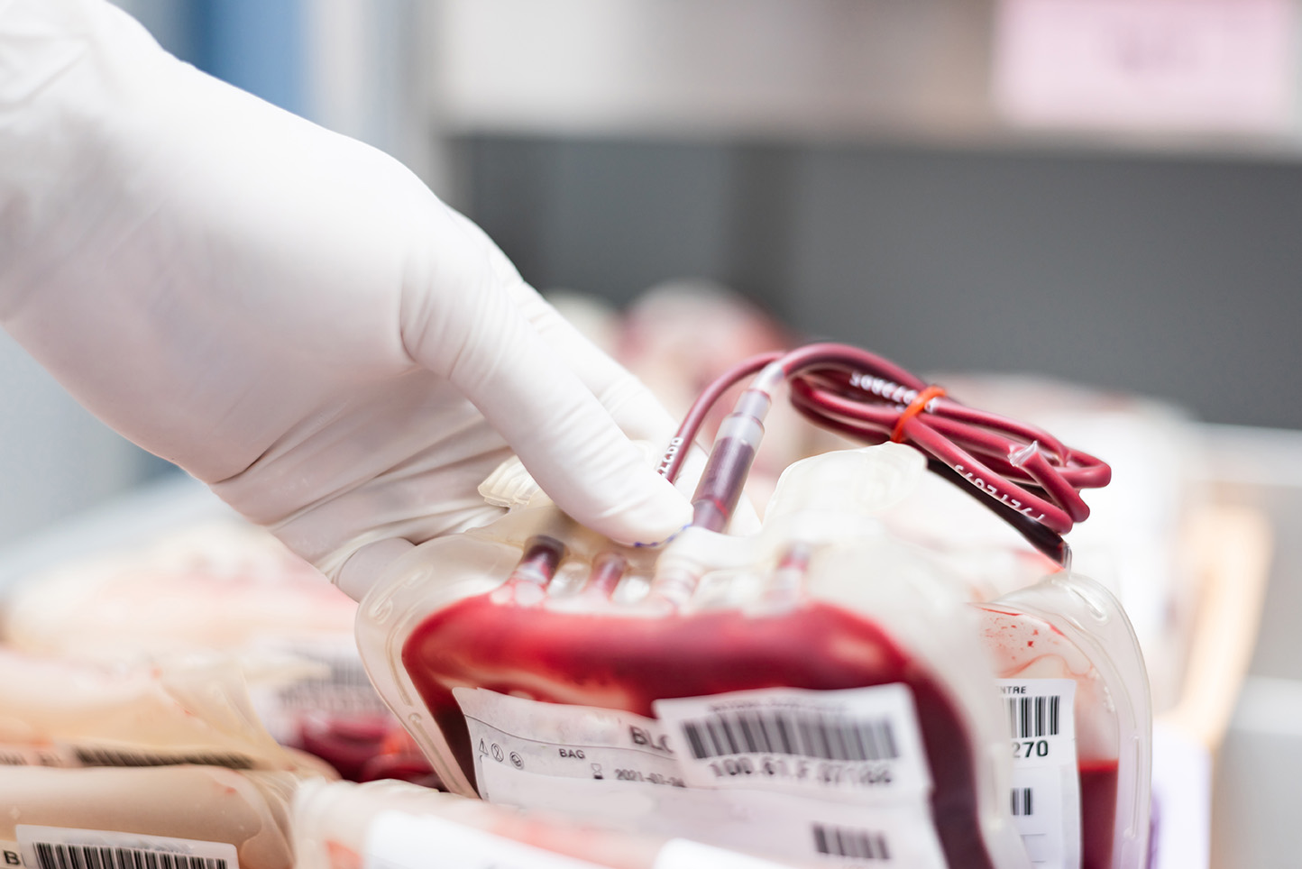 Gloved hand holding a blood storage bag filled with blood, with other bags in the background.