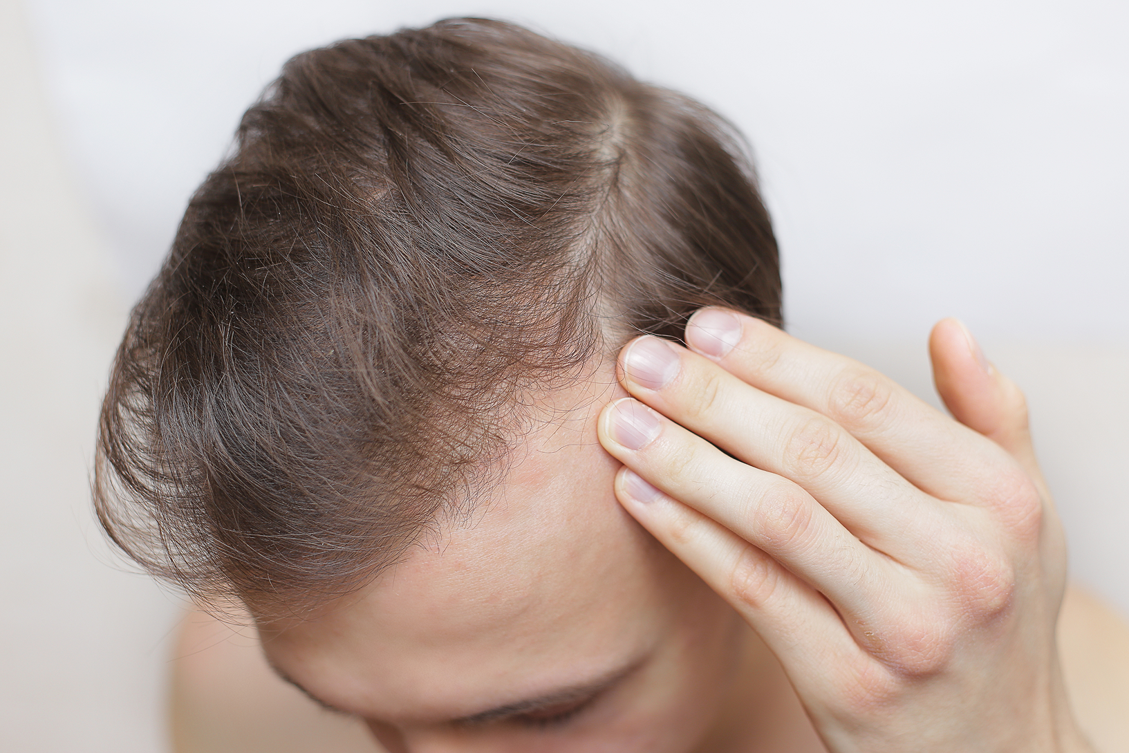man touching scalp