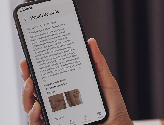 Smartphone screen showing digital health records with breast augmentation consultation details and images of breasts.