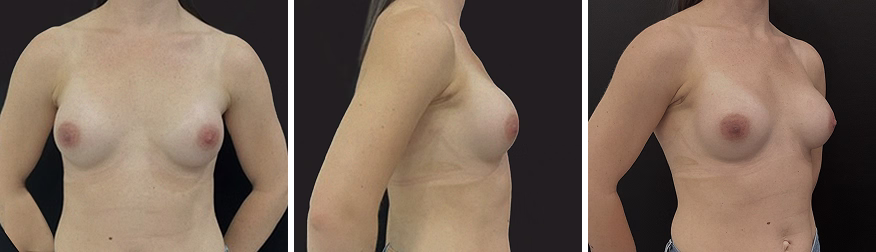 Mia Femtech™