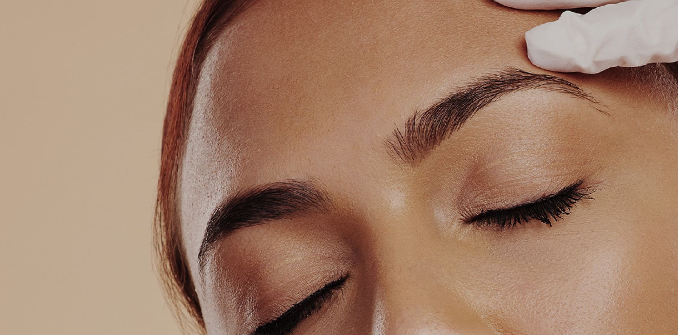Maximize Your Forehead Lift Results for 10-15 Years