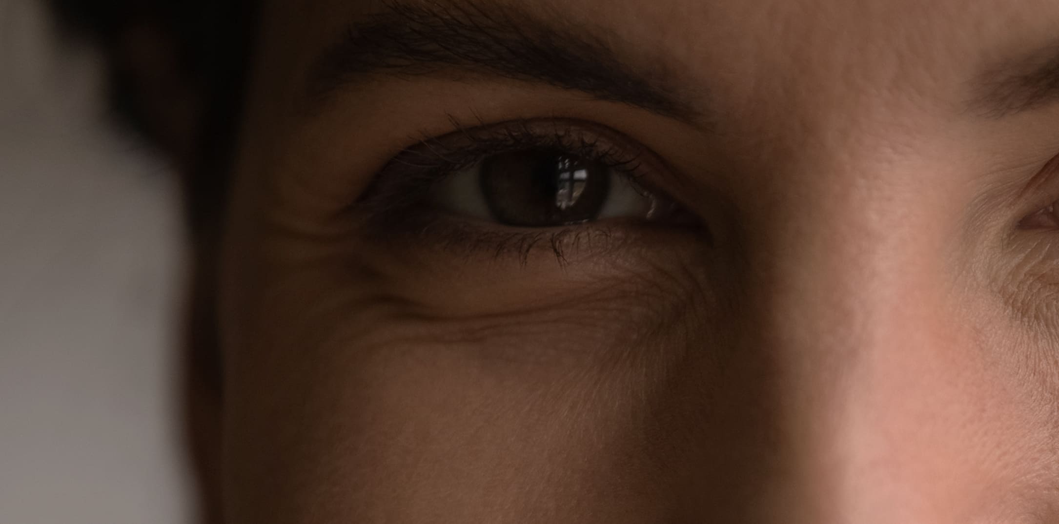 Discover if You're a Candidate for Eyelid Surgery