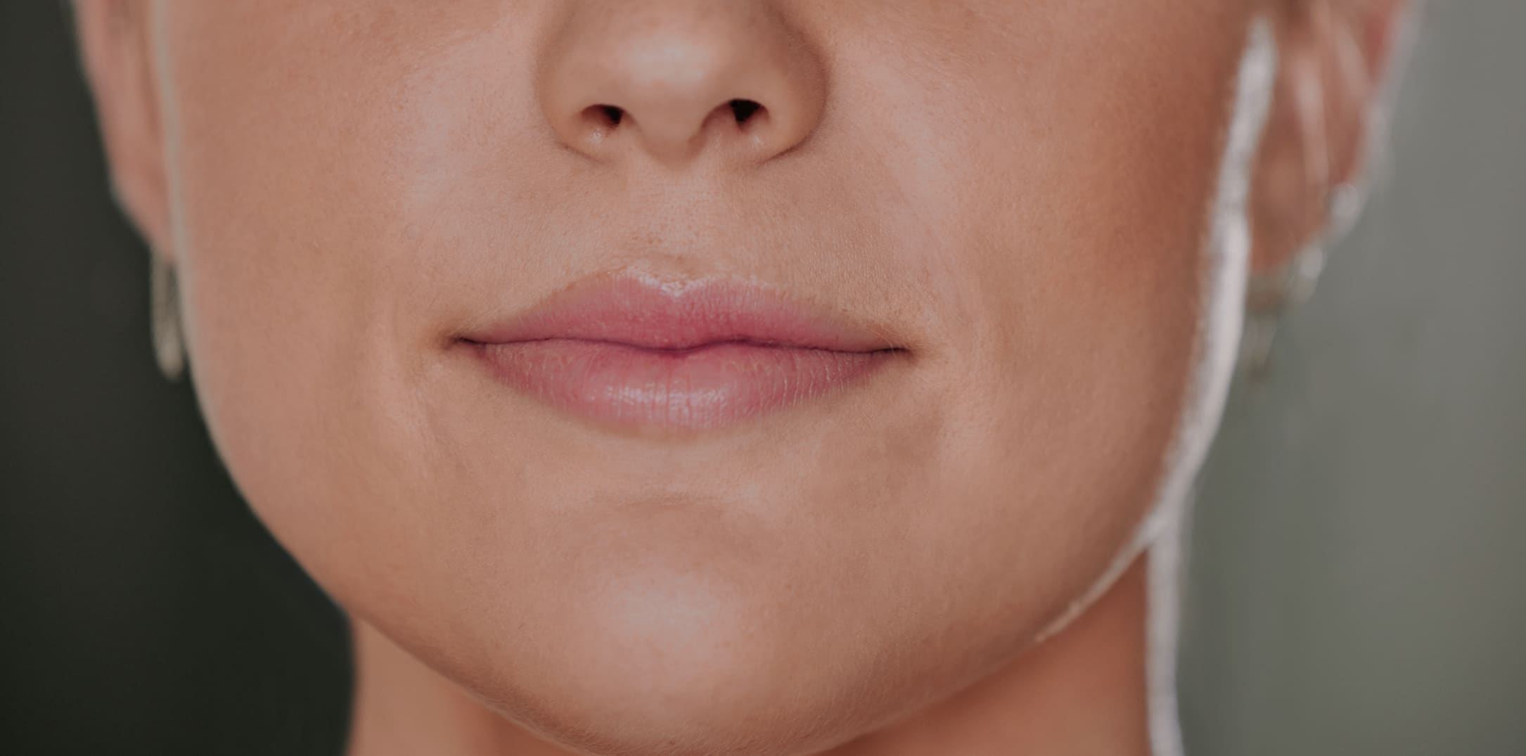 Your Ultimate Guide to Dermal Fillers at iQonic