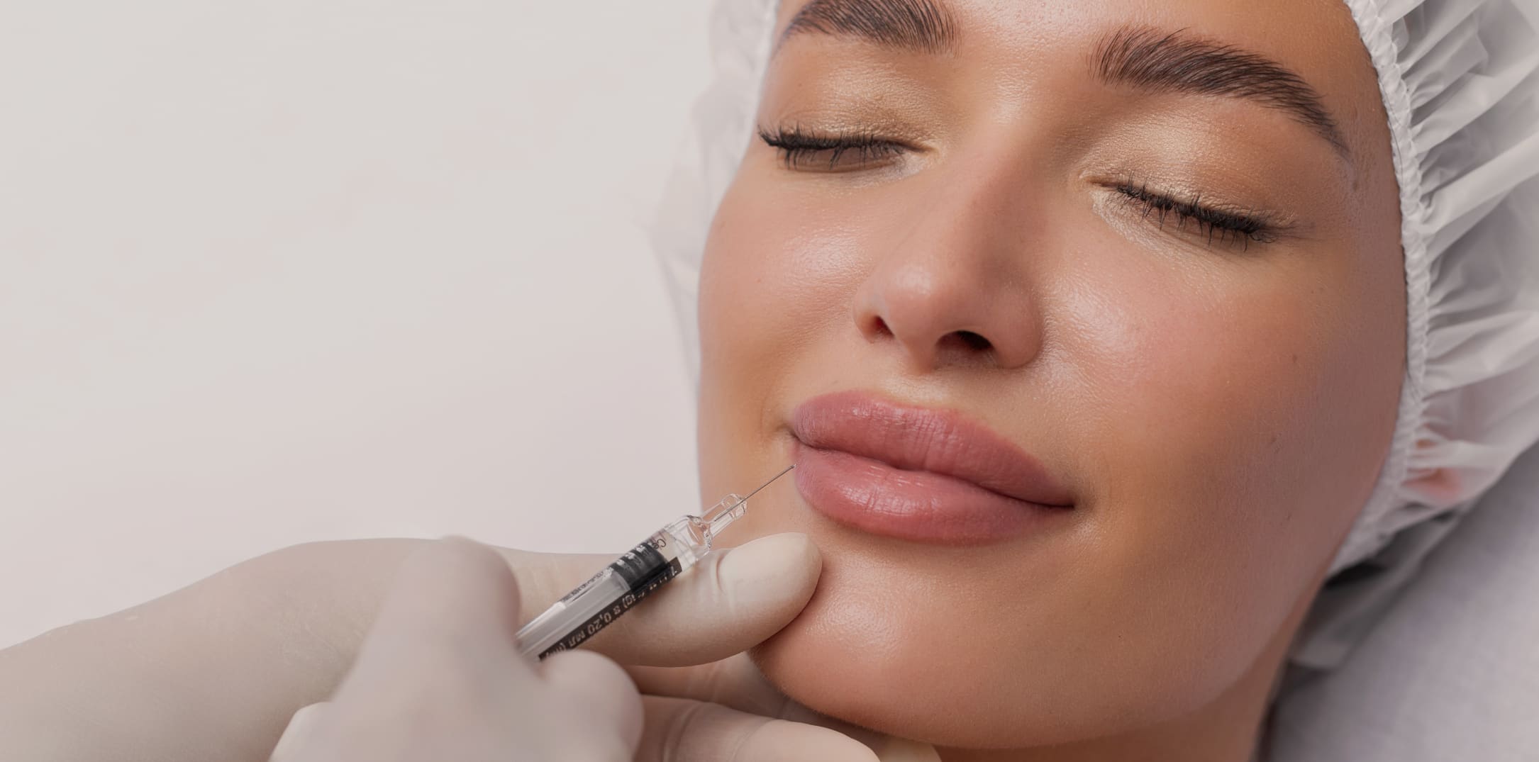 Enhance Your Lips Naturally with iQonic Lip Fillers