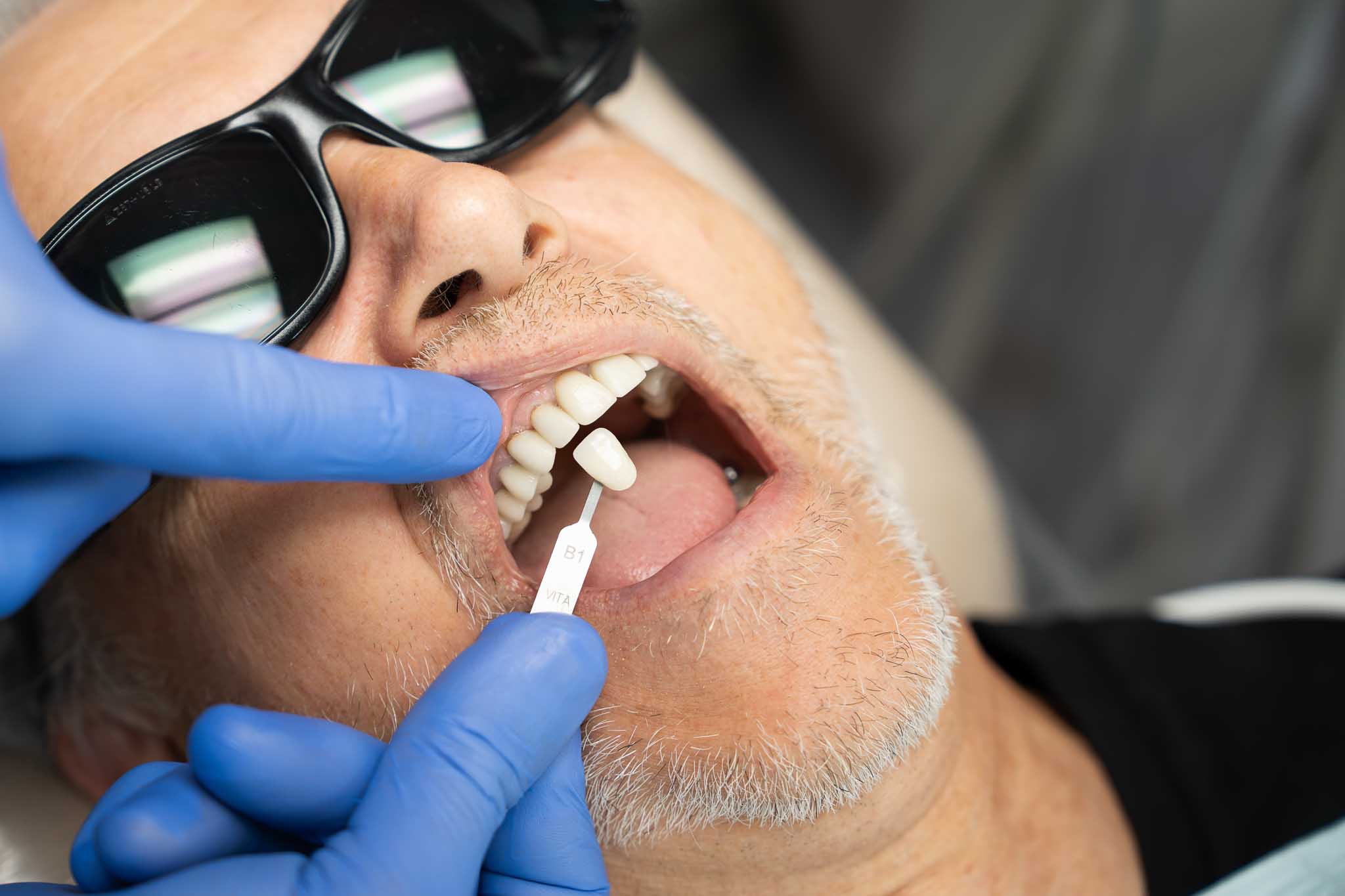 Cosmetic Dentist in Anacortes, WA 