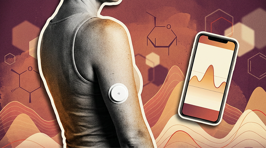 How We Use CGMs to Help Patients Take Control of Their Blood Sugar