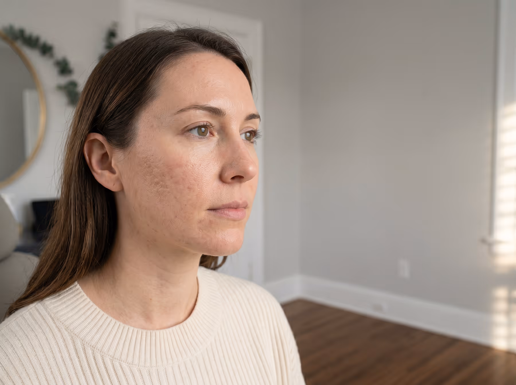 Acne and skin rejuvenation treatment at Charlotte Medical Aesthetics