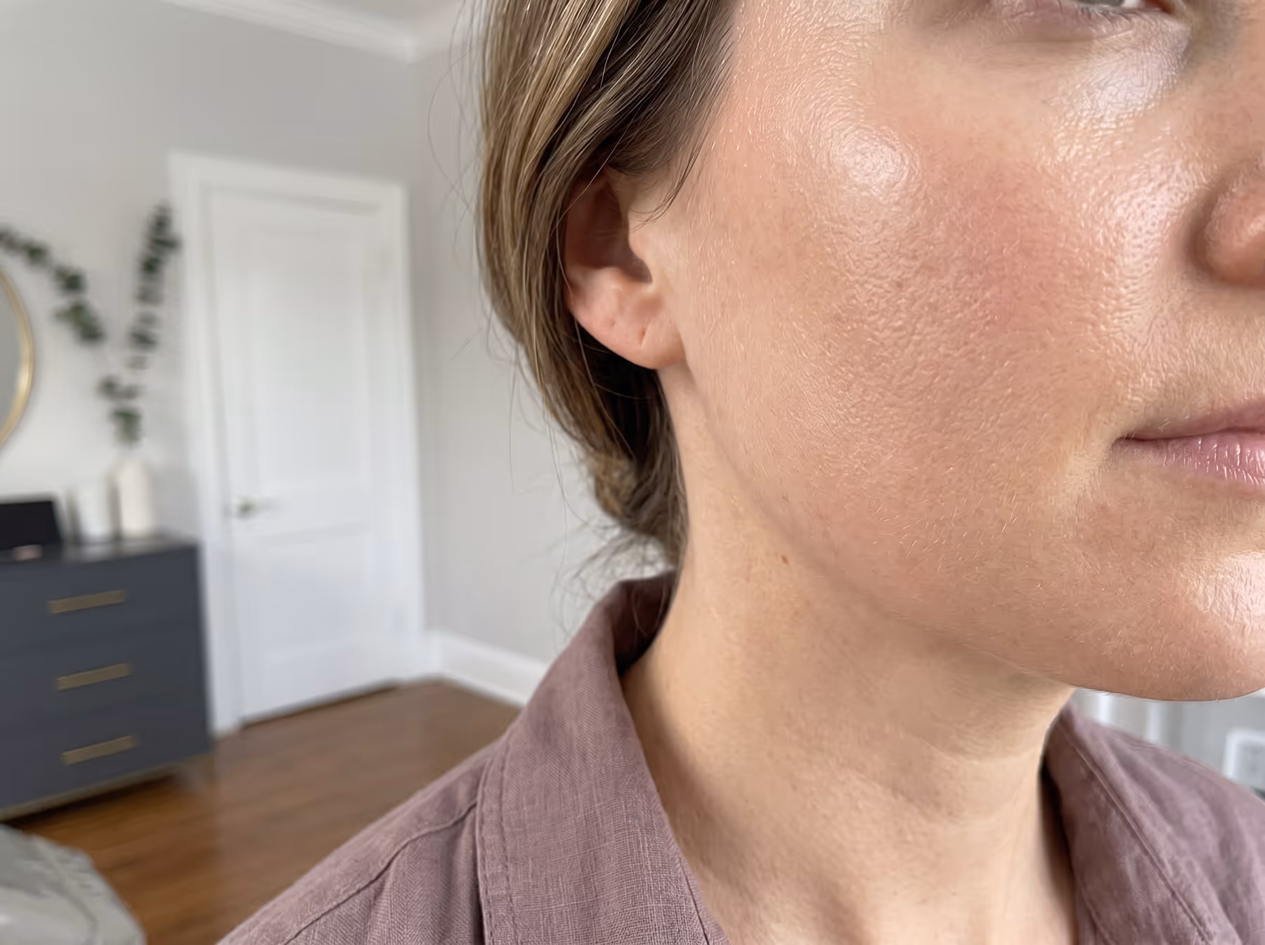 Microneedling skin rejuvenation treatment