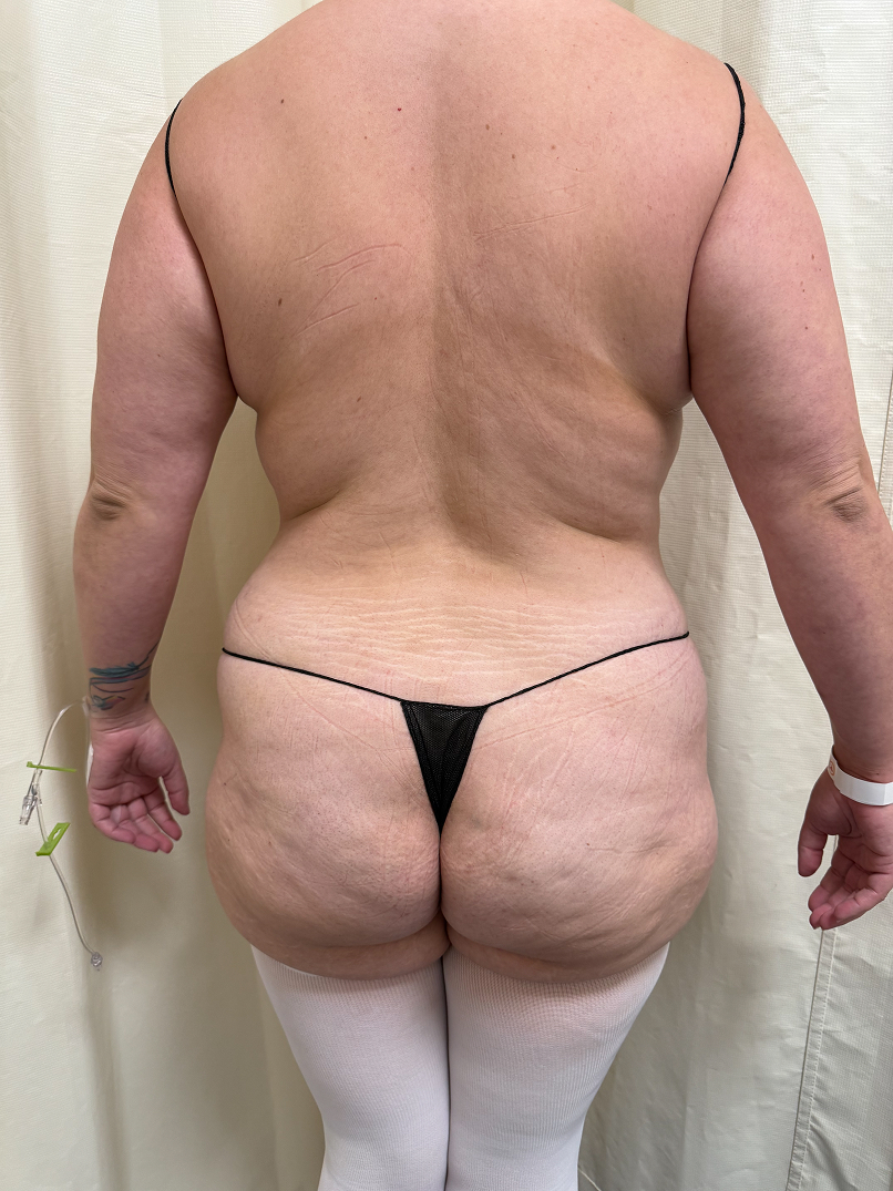 Rear view of a person with braided hair wearing a black thong and thin strap top against a plain white wall.