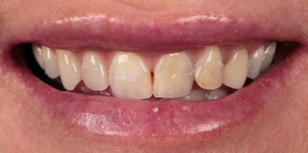 Before Image