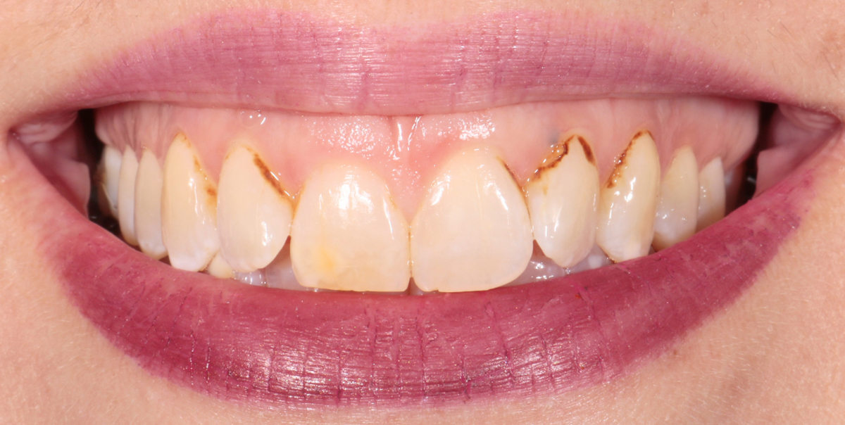 Before Image