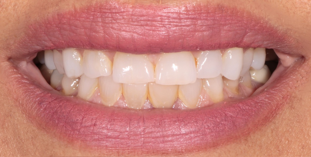 Before Image