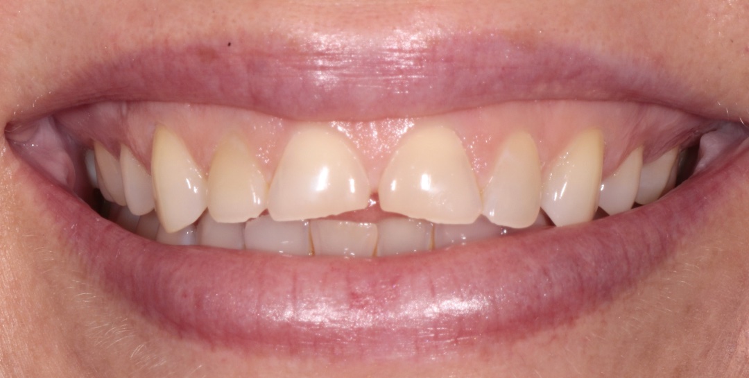 Before Image