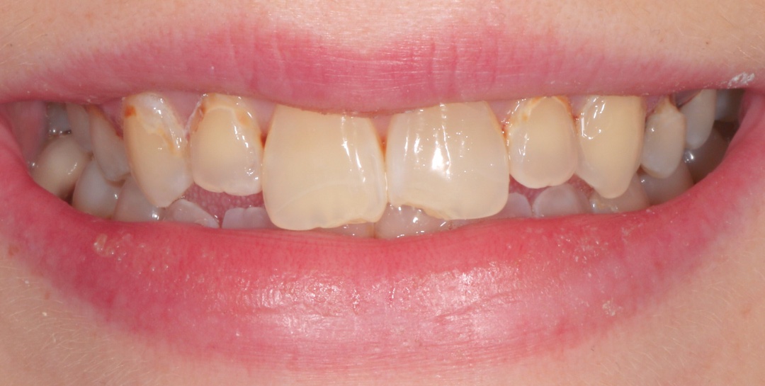 Before Image