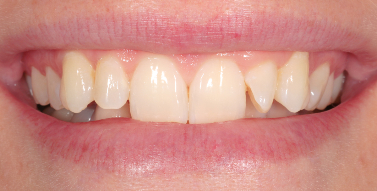 Before Image
