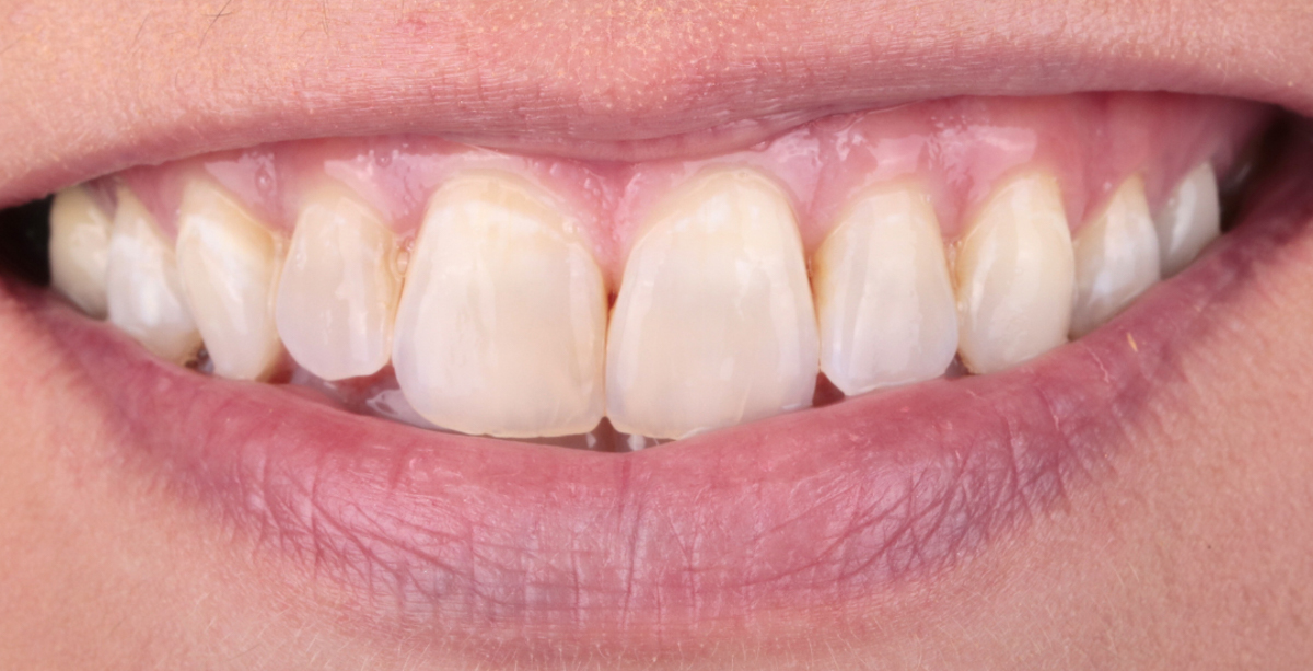 Before Image