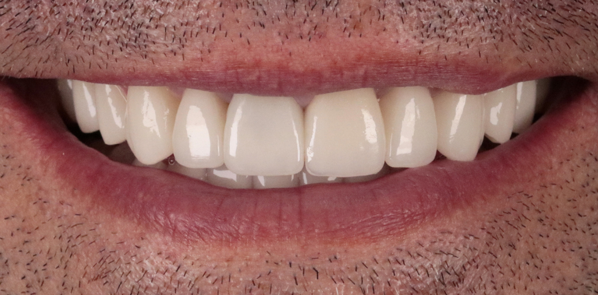 After Image