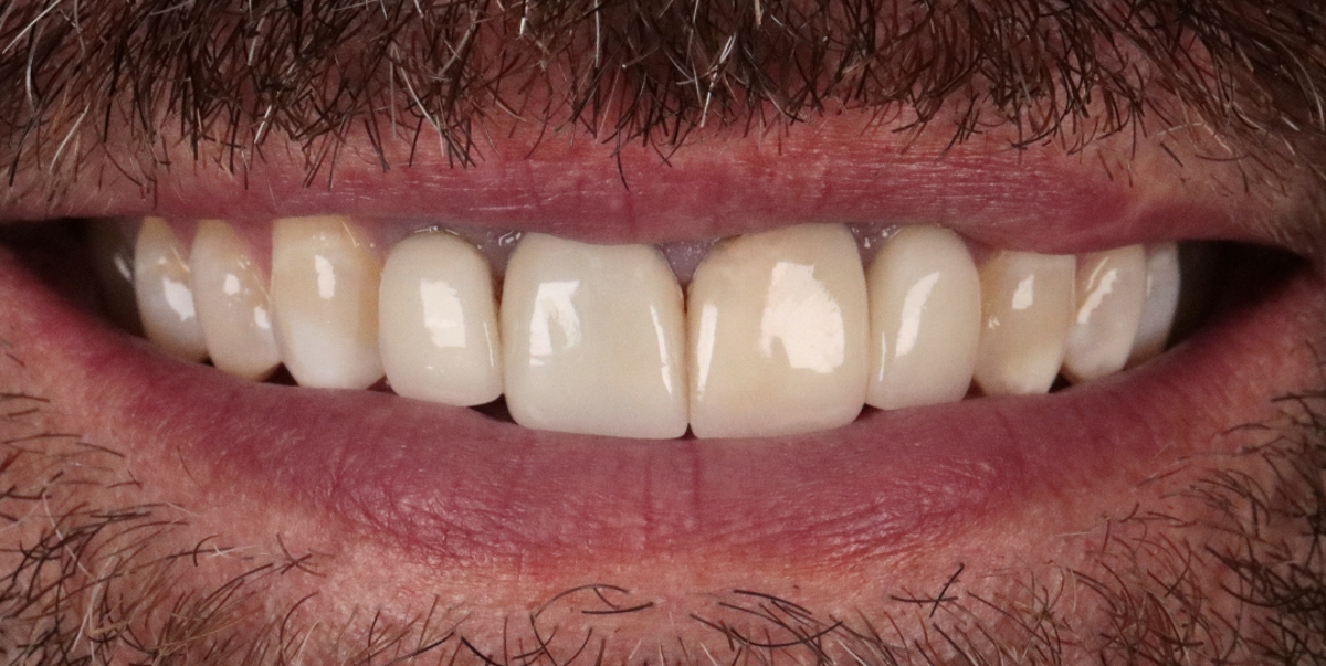 Before Image