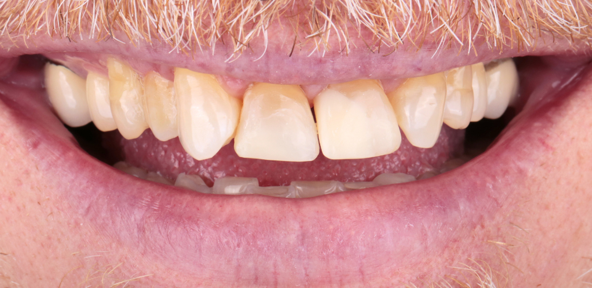 Before Image