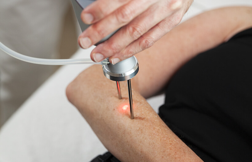 Unsere vielseitigen Hautlaser