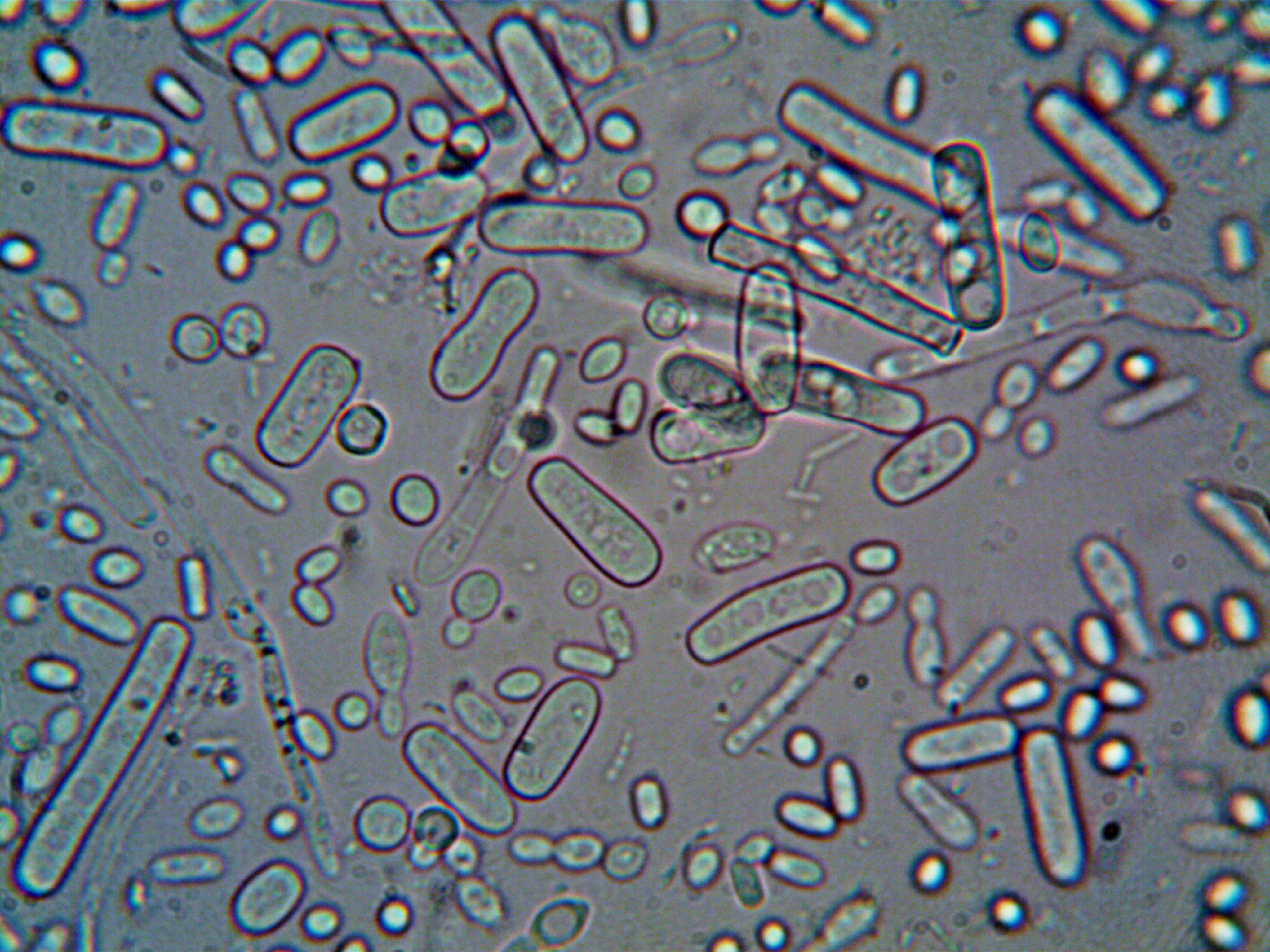 This is the main image for the blog hero section. It shows a current image related to the blog.