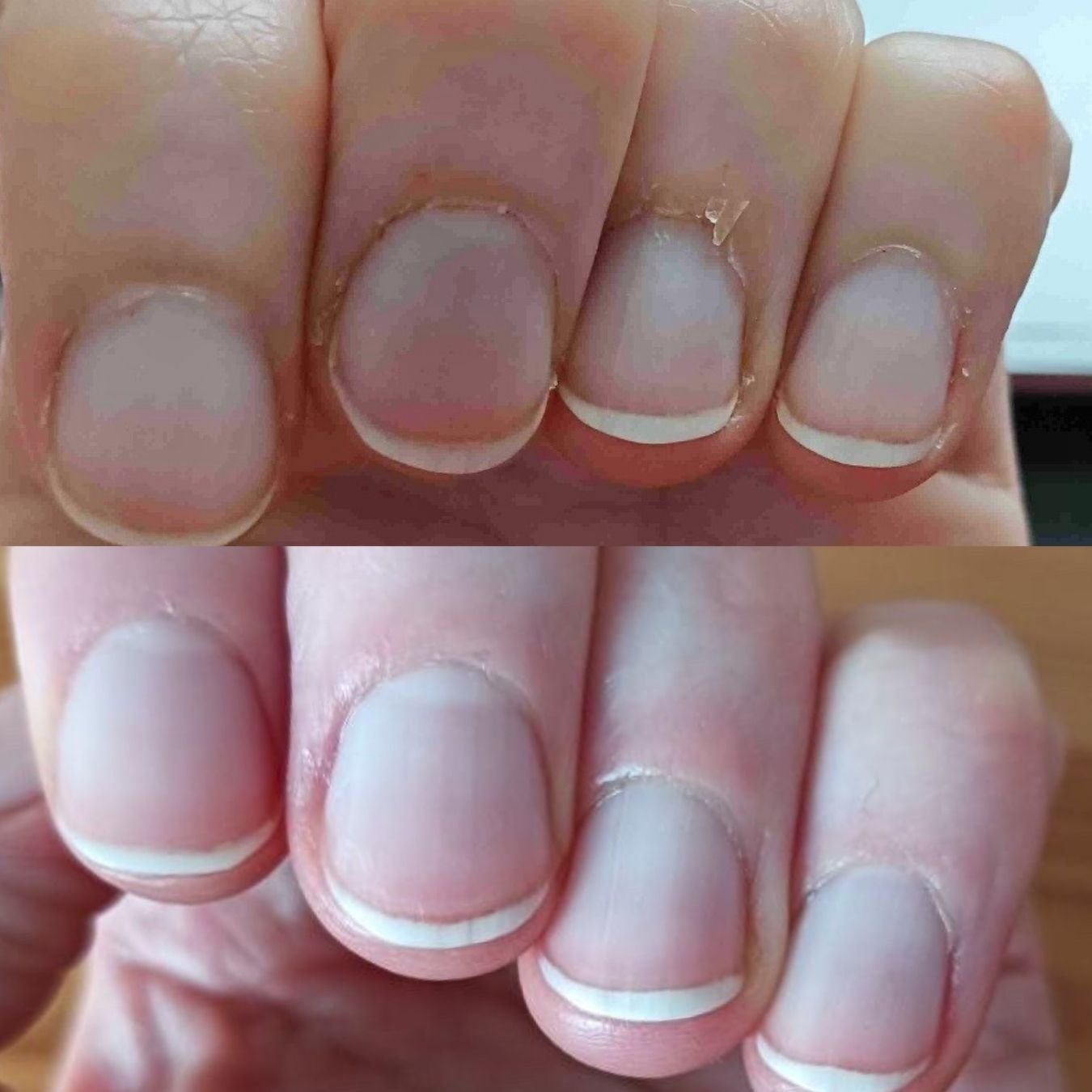 Side-by-side comparison of four fingernails showing unhealthy nails with peeling cuticles in the top image and healthy, well-groomed nails in the bottom image.