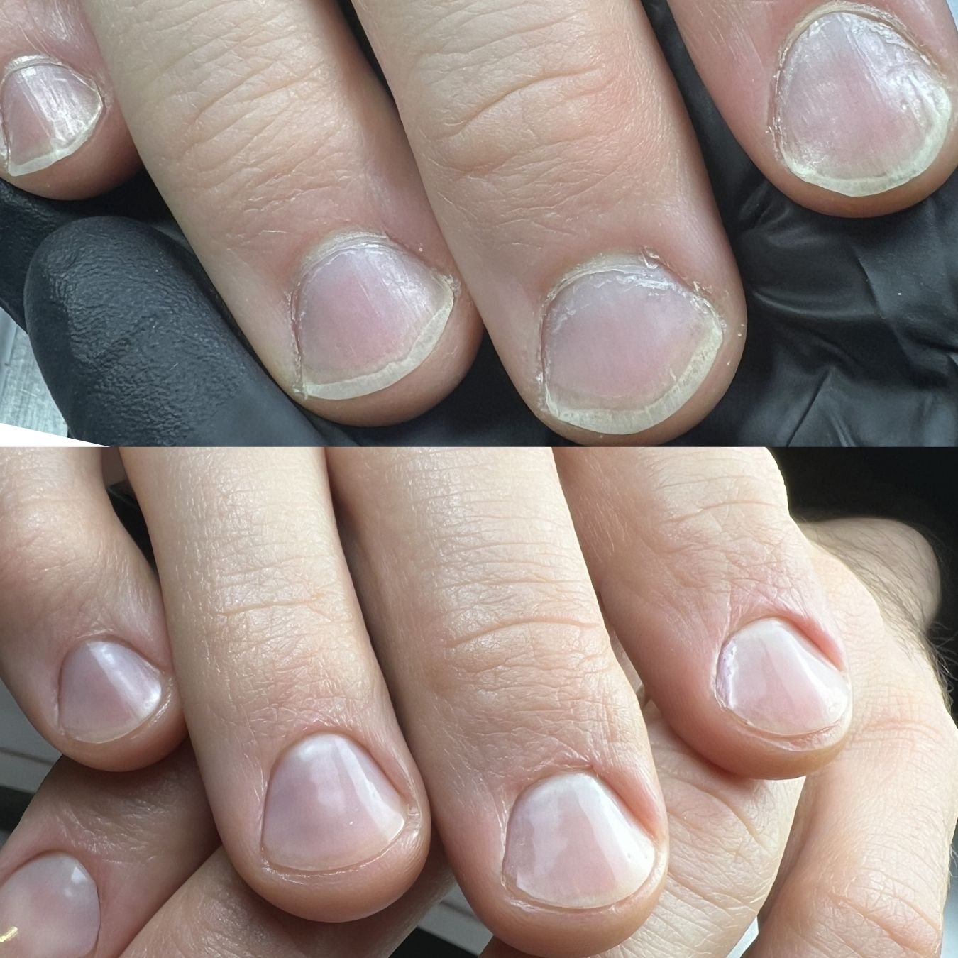 Close-up comparison of fingernails before and after a manicure, showing rough, dry nails with cuticle damage in the top image and smooth, hydrated nails in the bottom image.