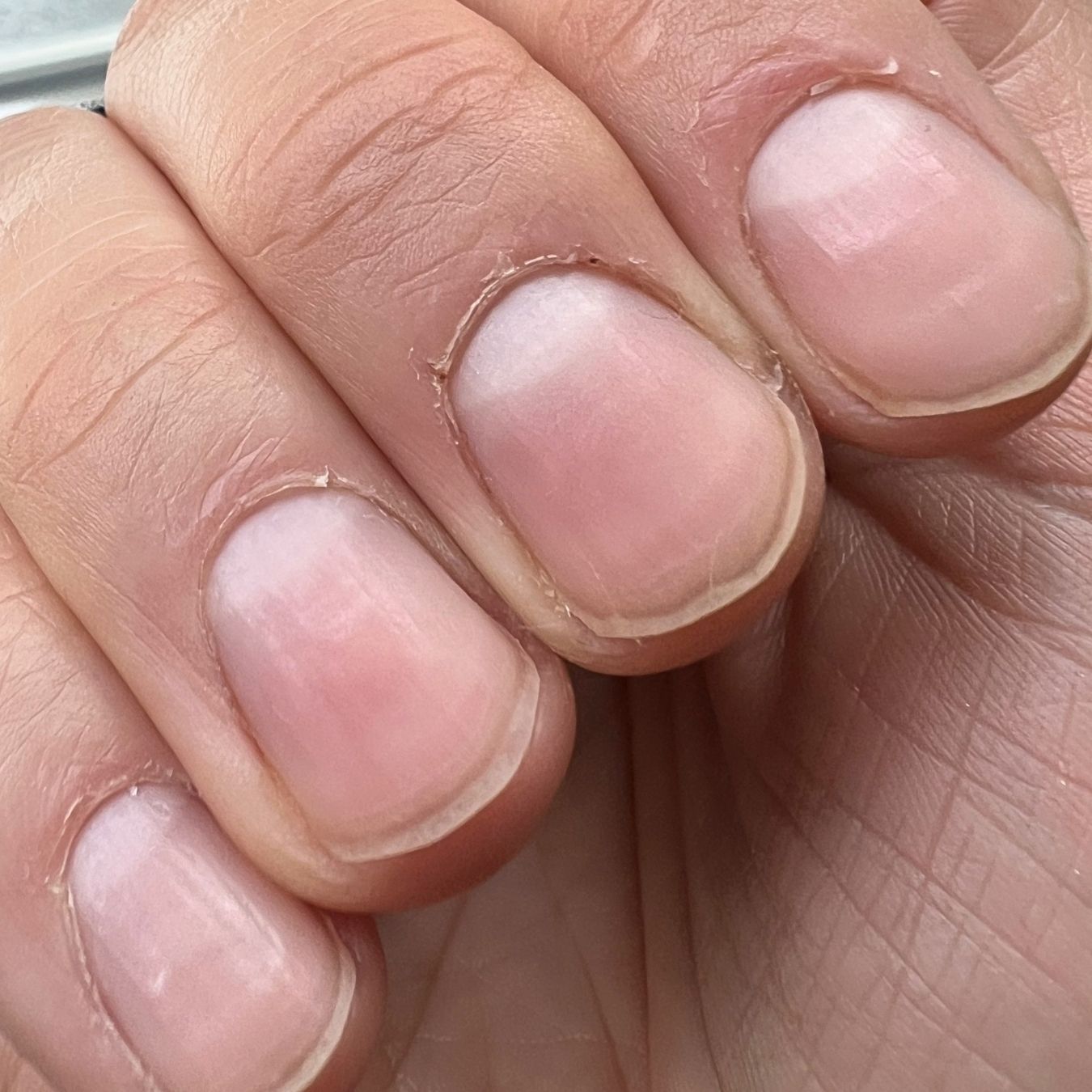Close-up of four fingernails with short, natural nails and slightly dry cuticles.