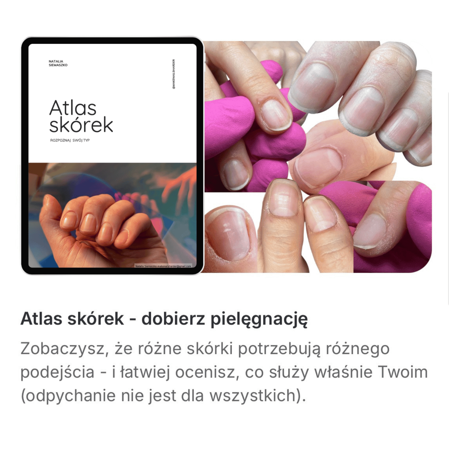Collage showing an ebook cover titled 'Atlas skórek' on a tablet and close-up images of different types of fingernail cuticles on human fingers.